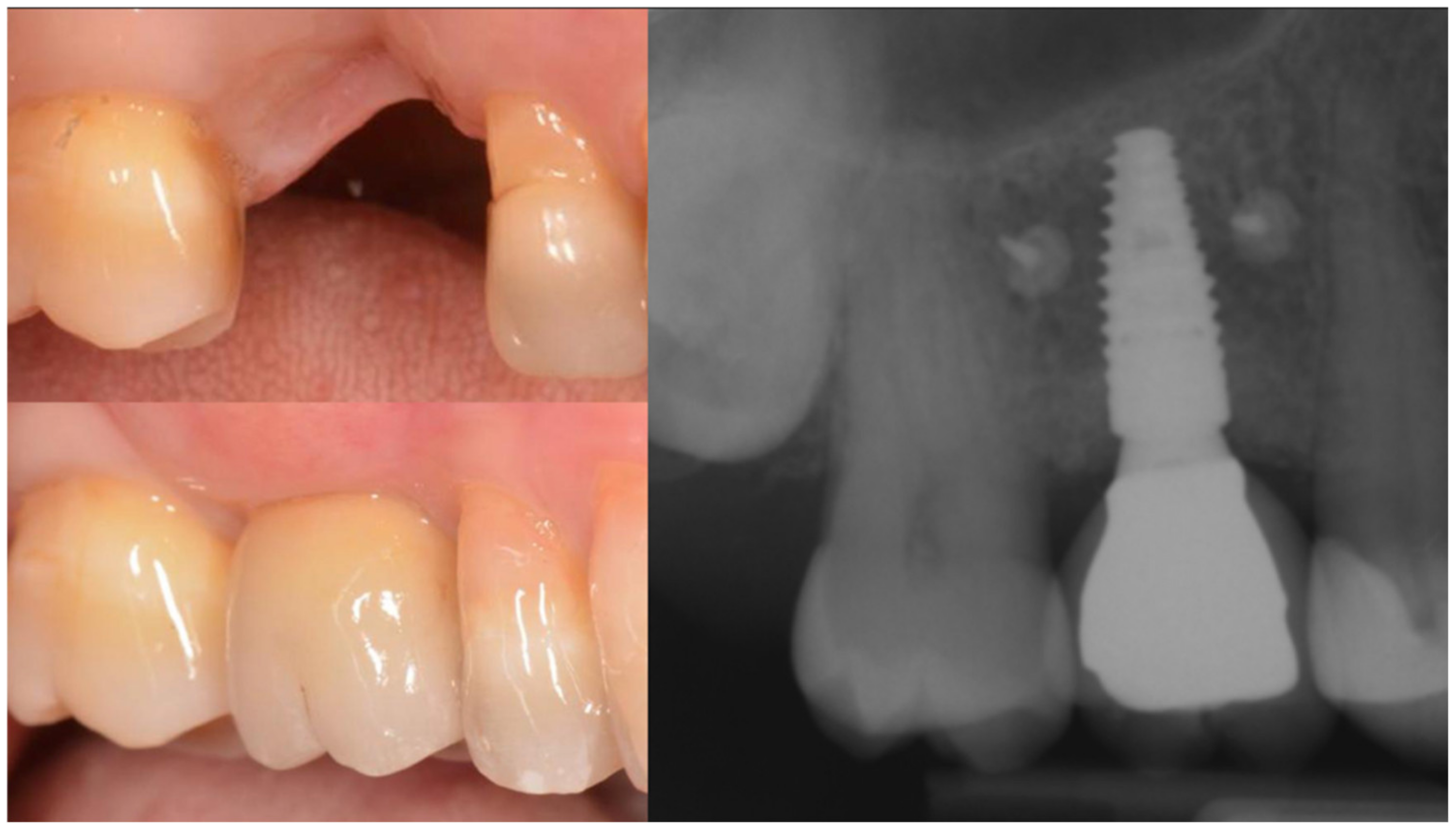 Applsci 12 11247 g012