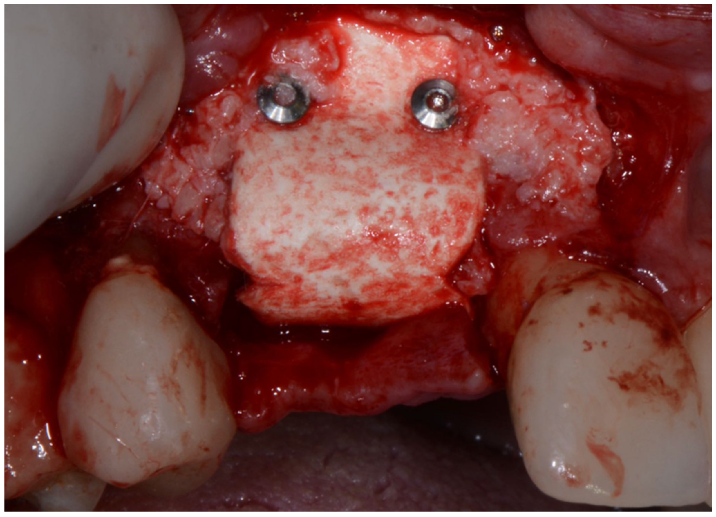 Applsci 12 11247 g015