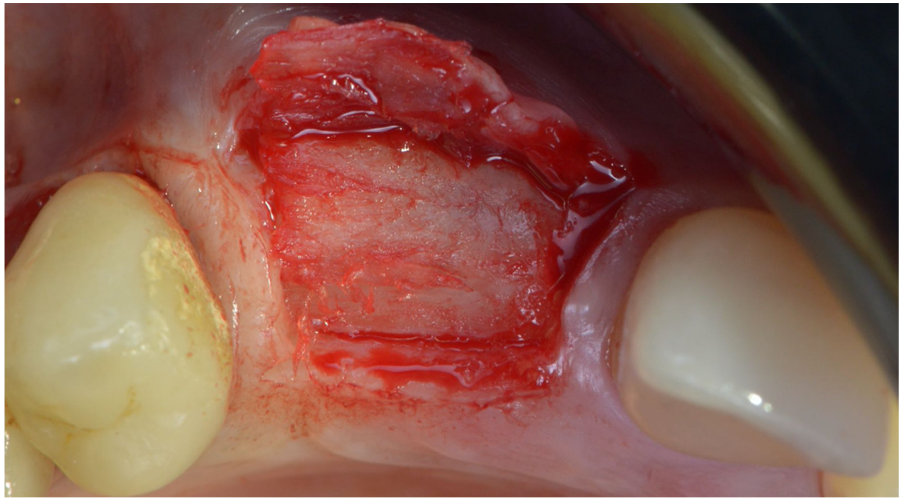 Applsci 12 11247 g017