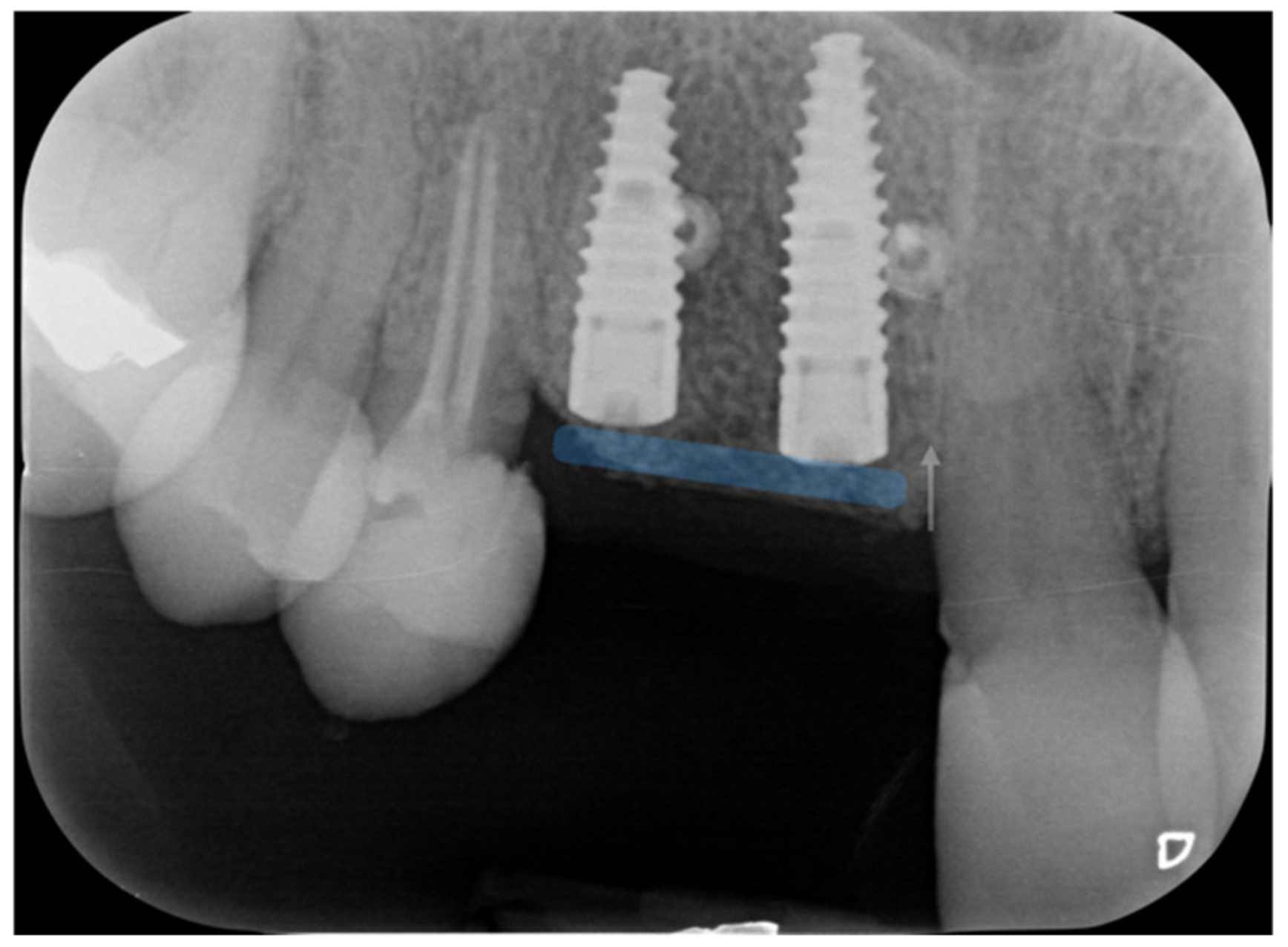 Applsci 12 11247 g020