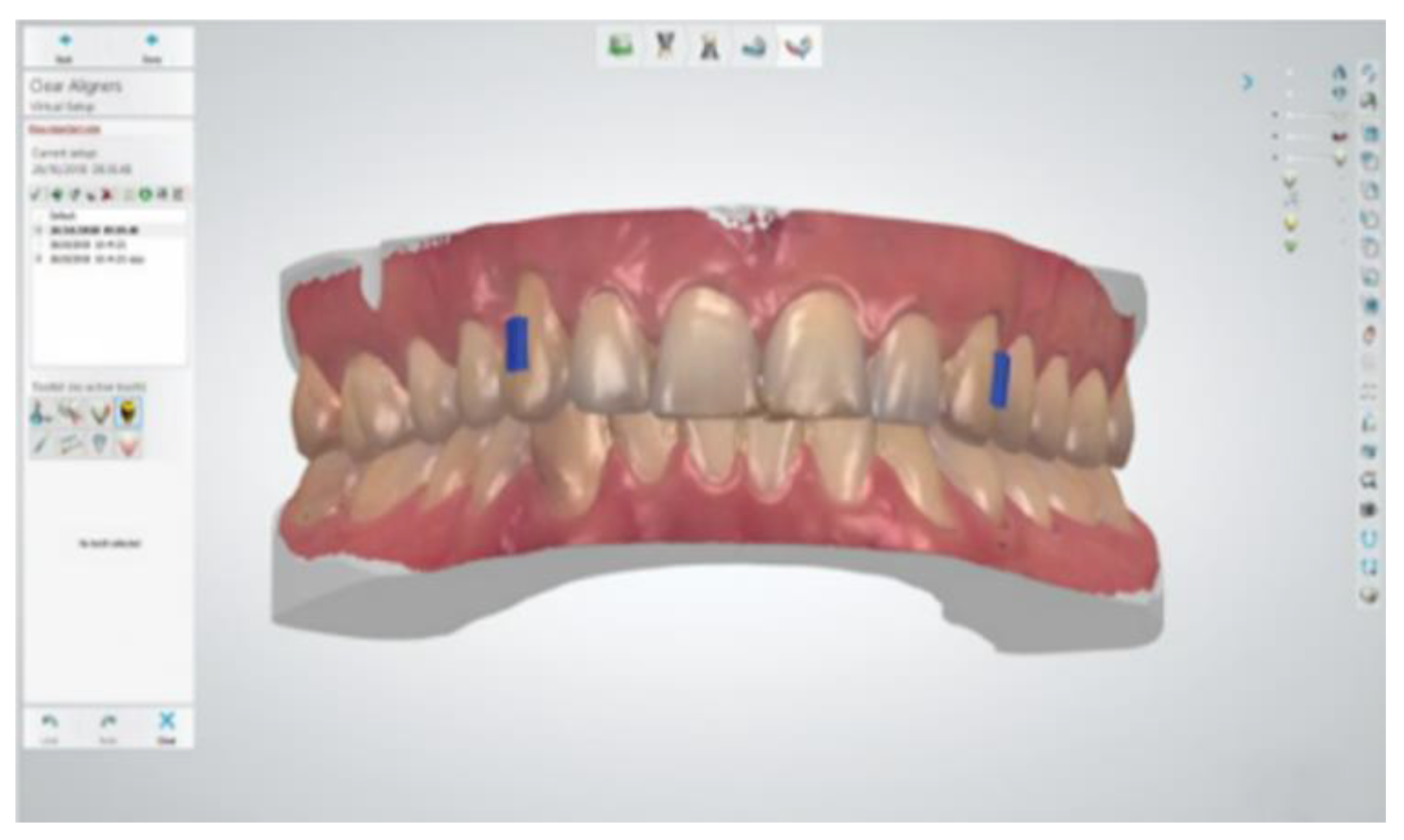 Applsci 12 11274 g002 Applsci 12 11274 g002