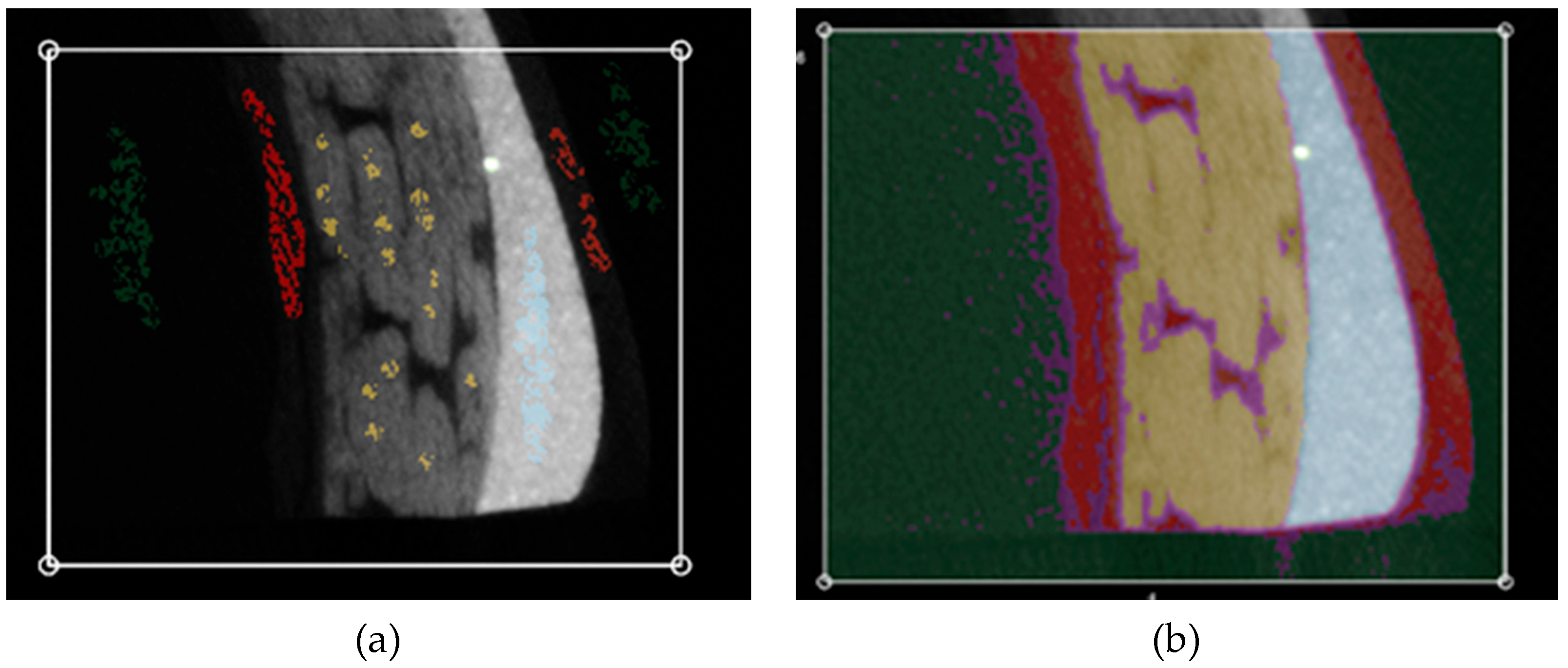 Applsci 12 11307 g008 Applsci 12 11307 g008