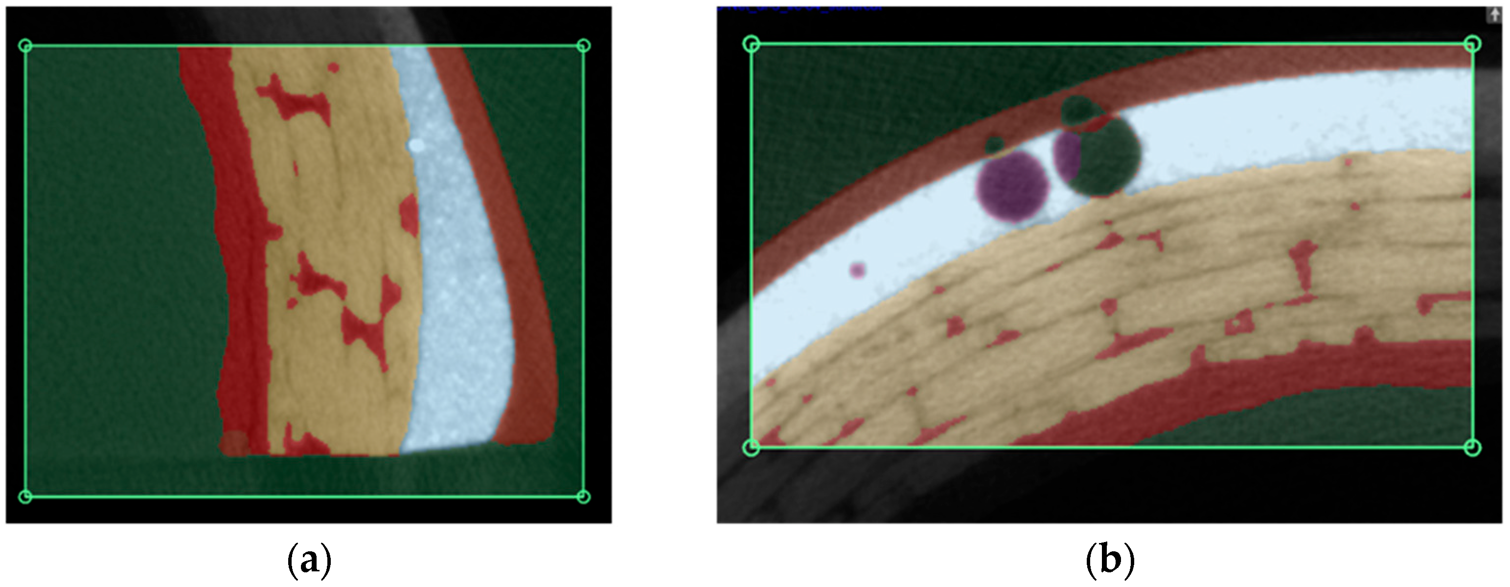 Applsci 12 11307 g011 Applsci 12 11307 g011