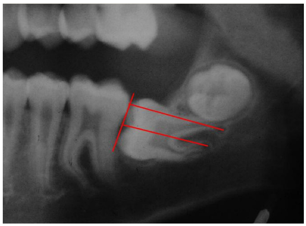 Applsci 12 11520 g005