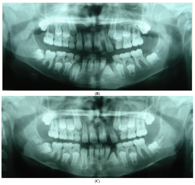 Applsci 12 11520 g007b