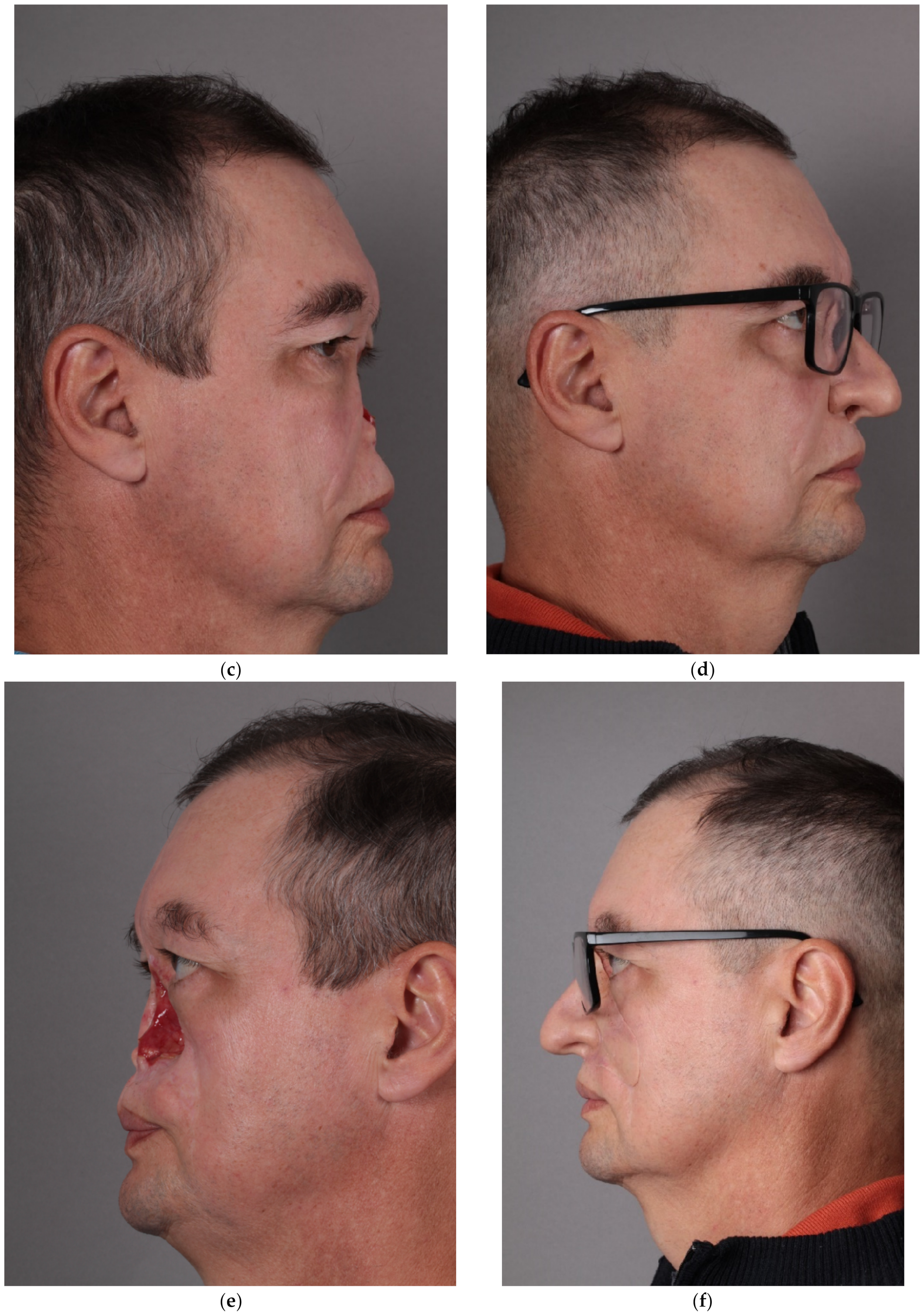 Applsci 12 11974 g003b