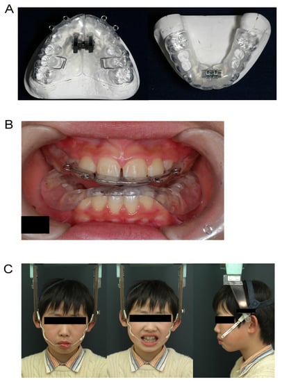 Applsci 12 12268 g001