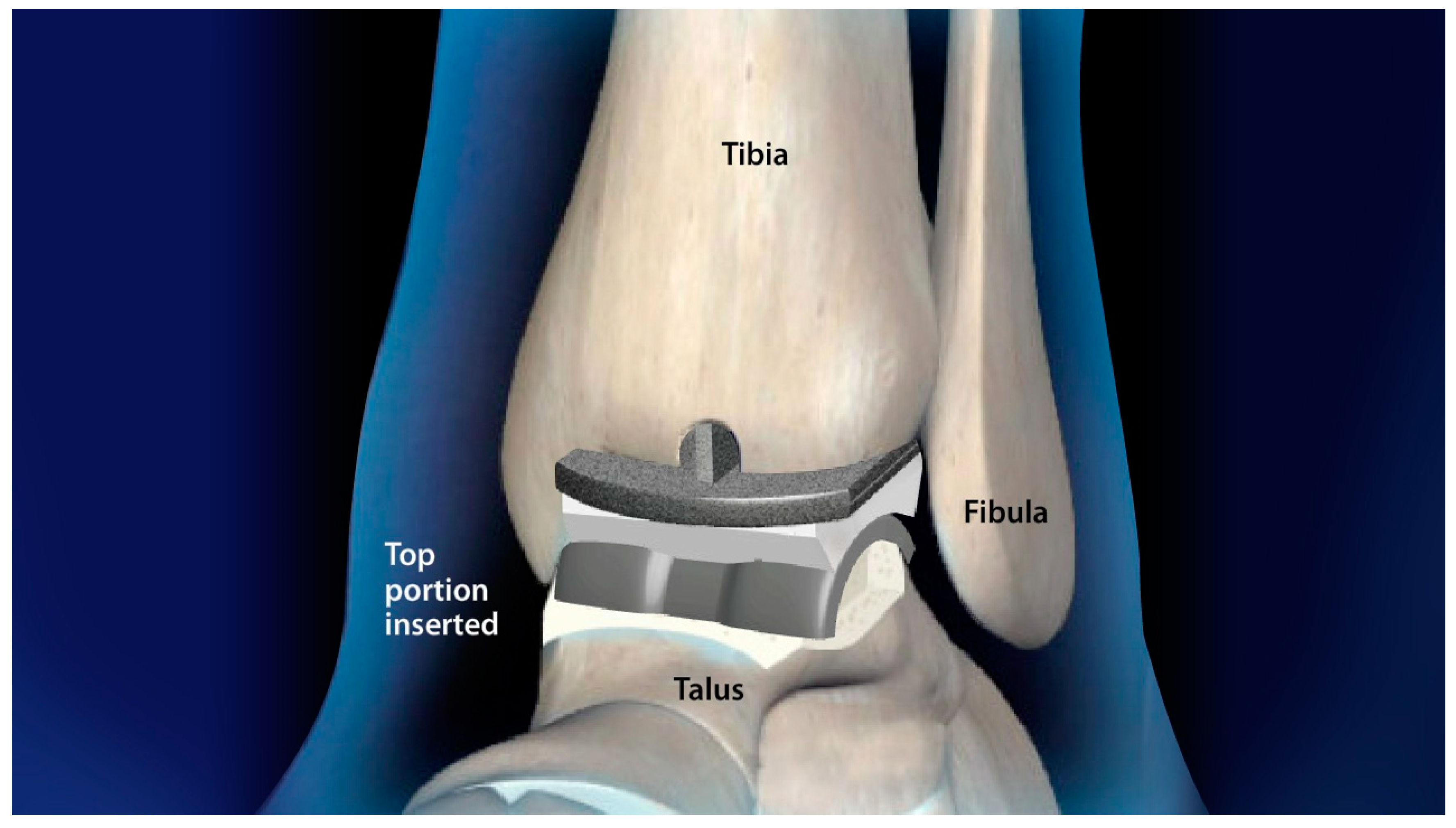 Applsci 13 00535 g003