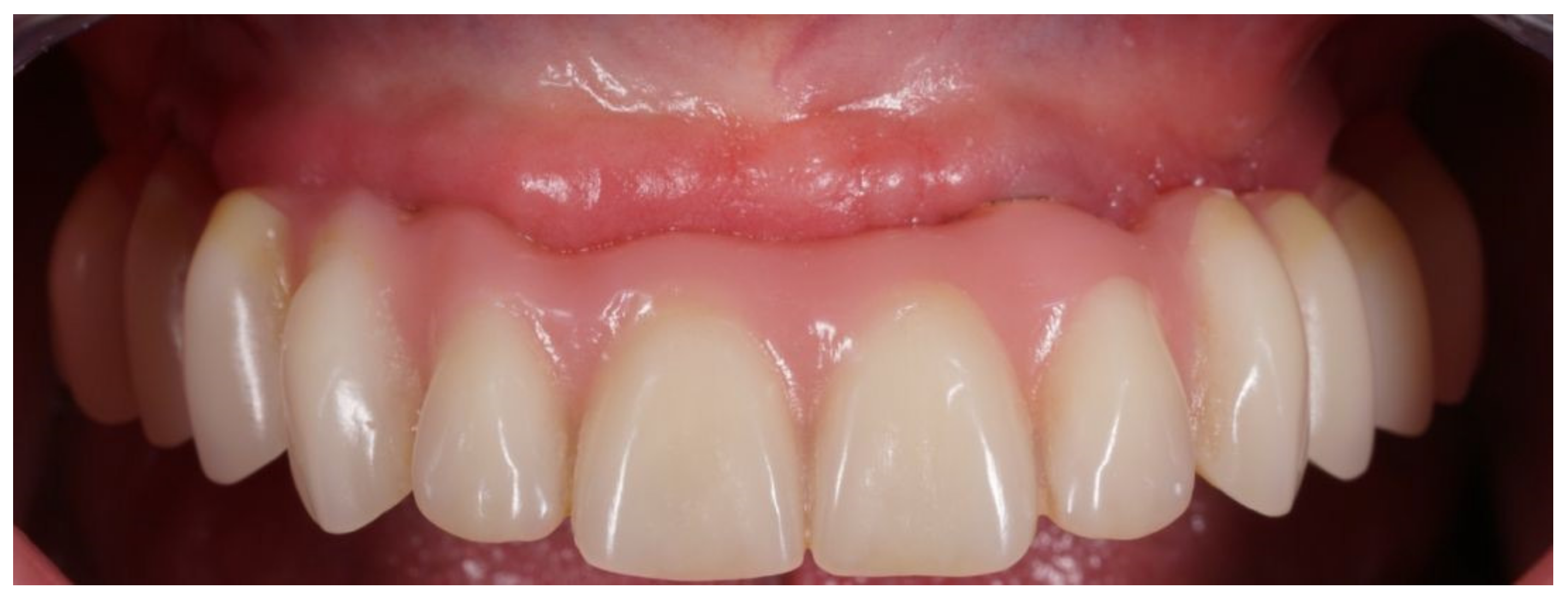 Applsci 13 00538 g006