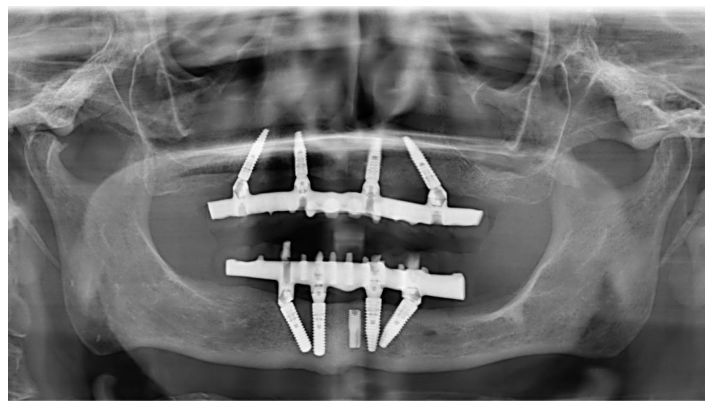 Applsci 13 00538 g008