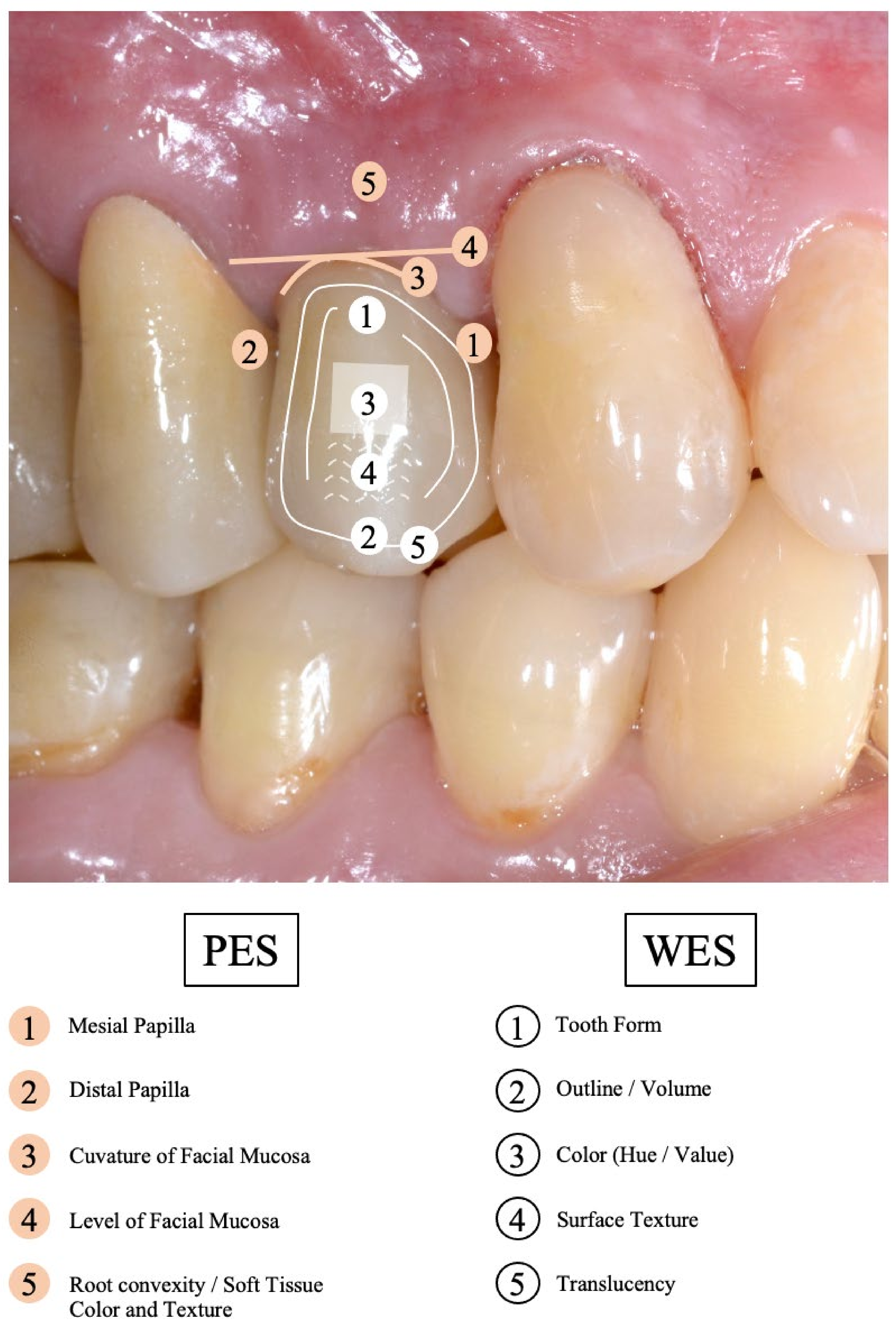 Applsci 13 00661 g004