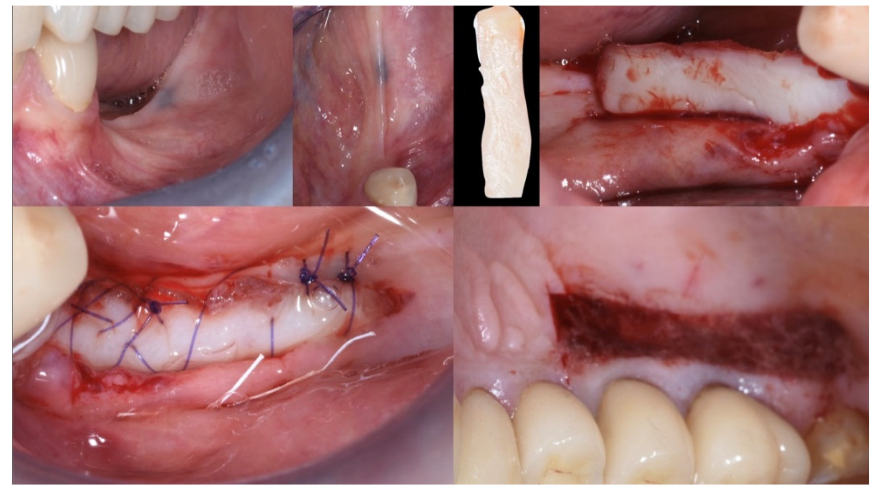 Applsci 13 00692 g004