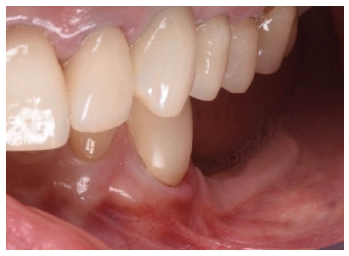 Applsci 13 00692 g005