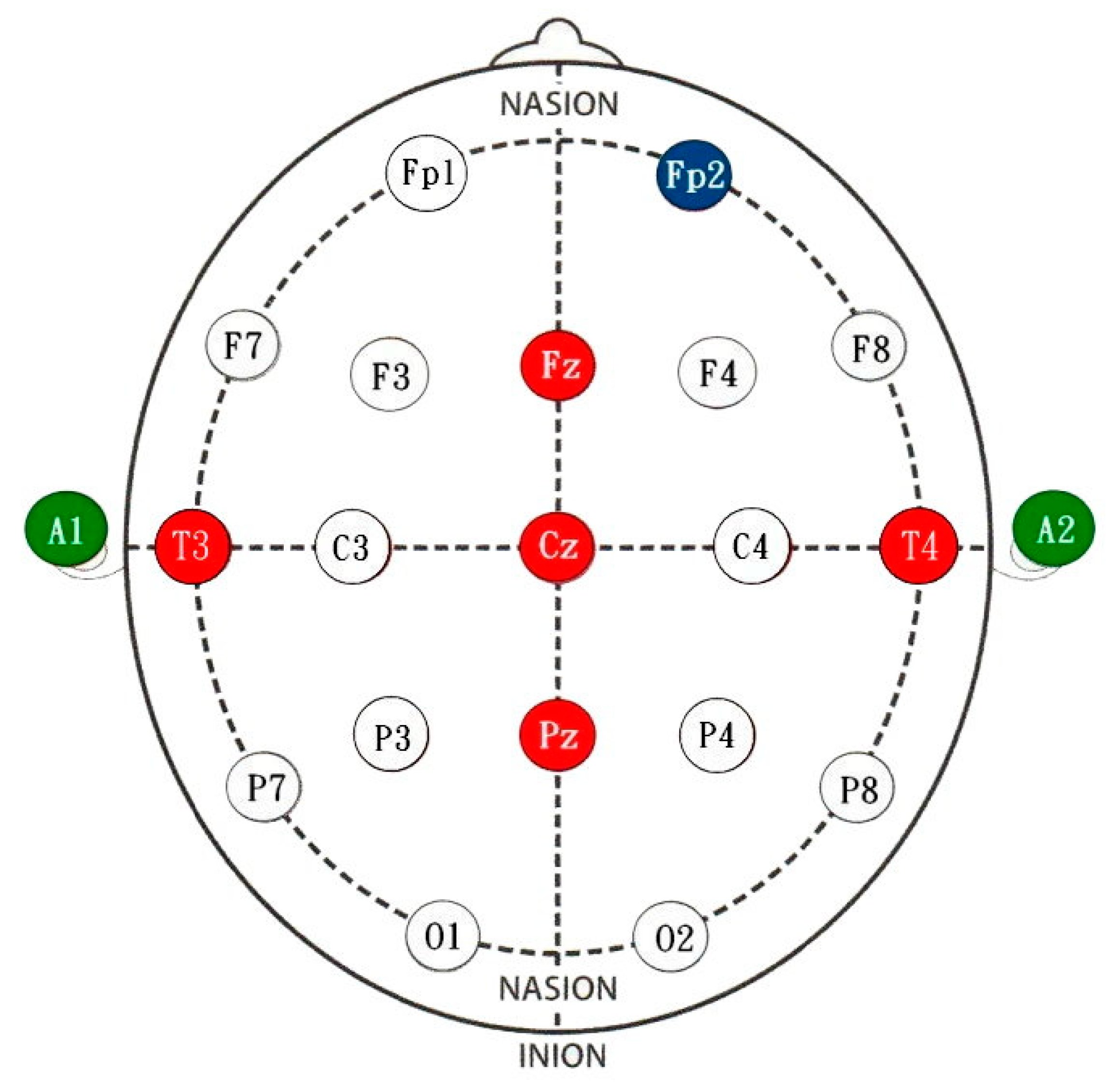 Applsci 13 00856 g005