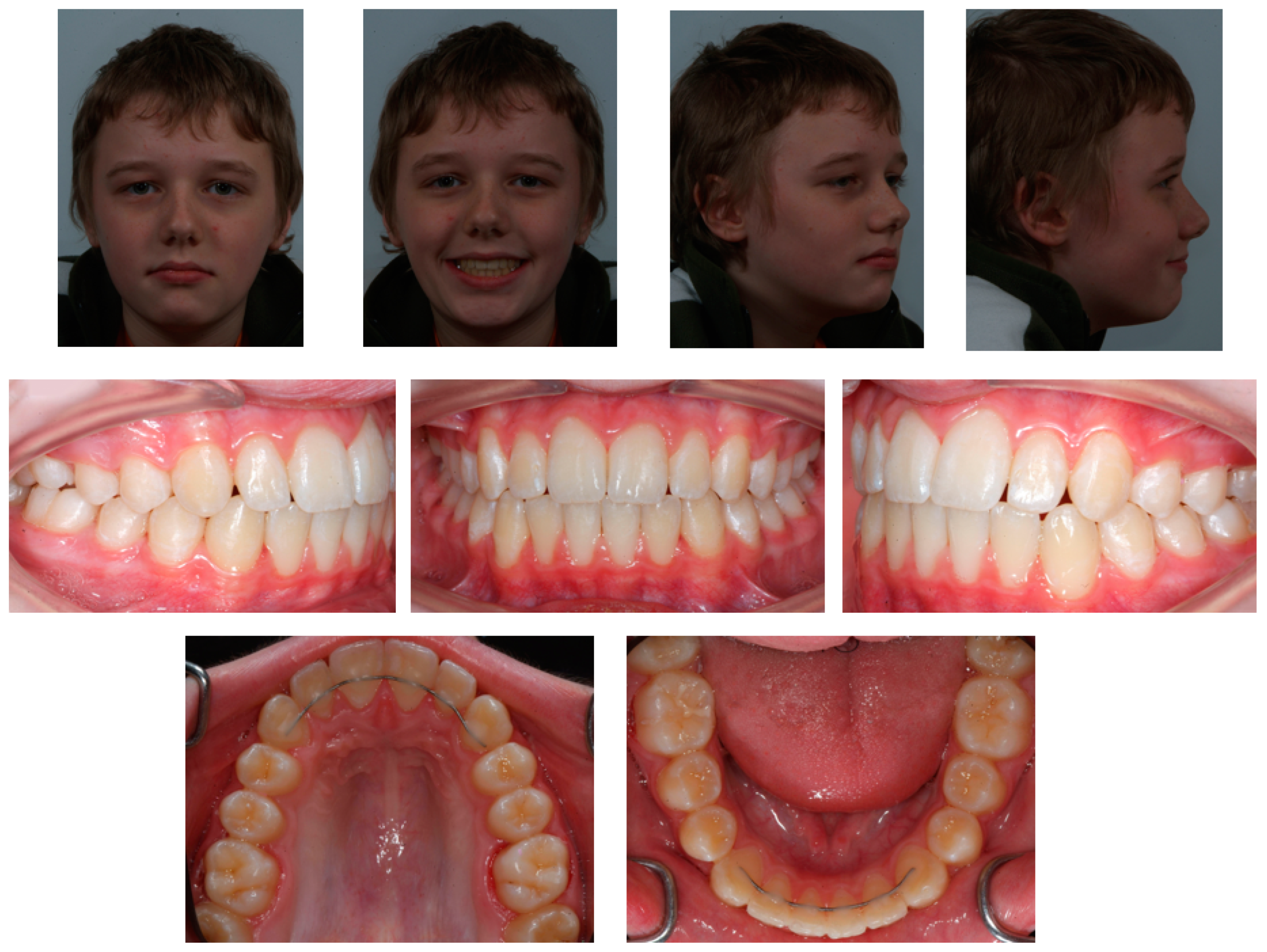 Applsci 13 00922 g002