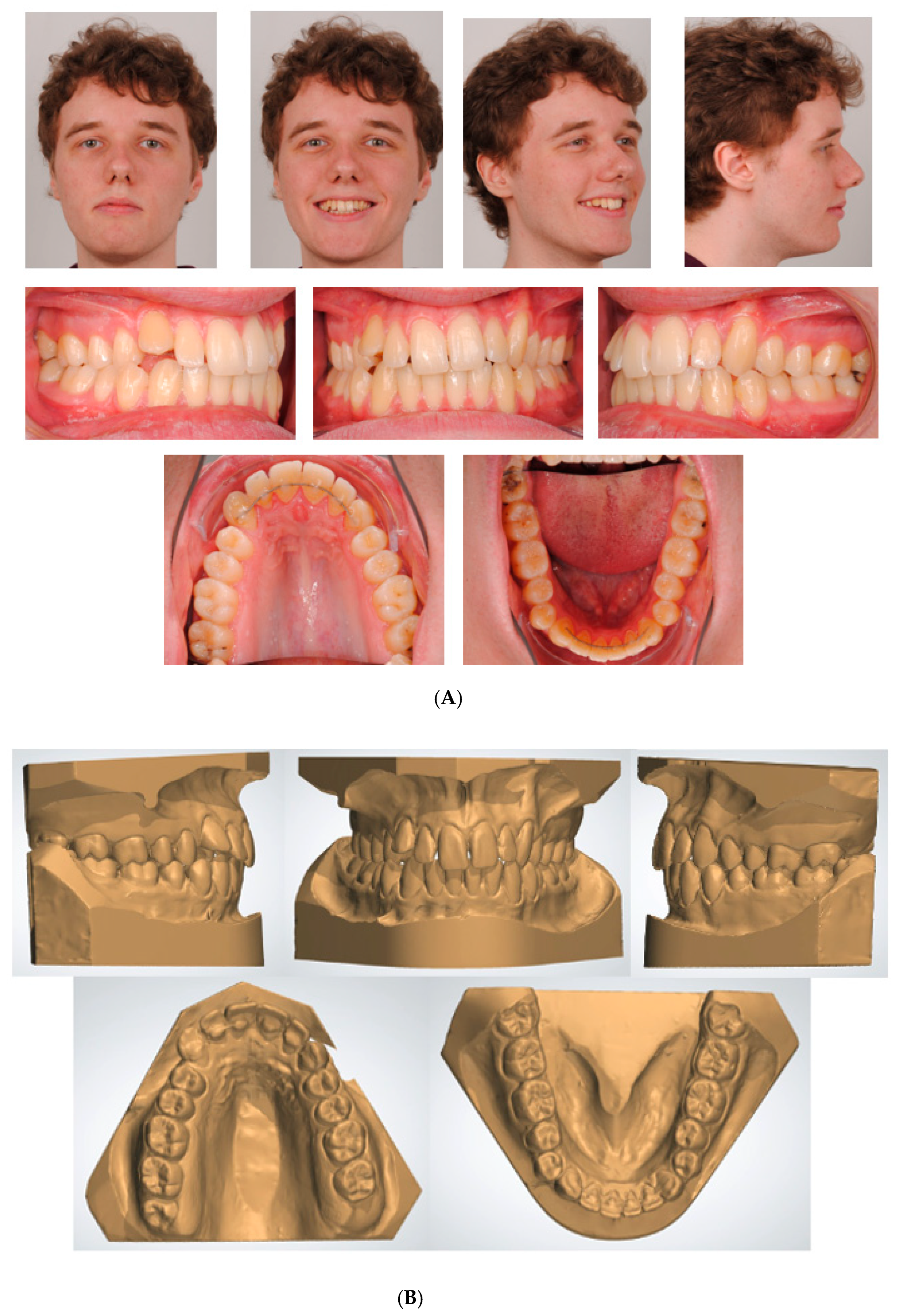Applsci 13 00922 g003a