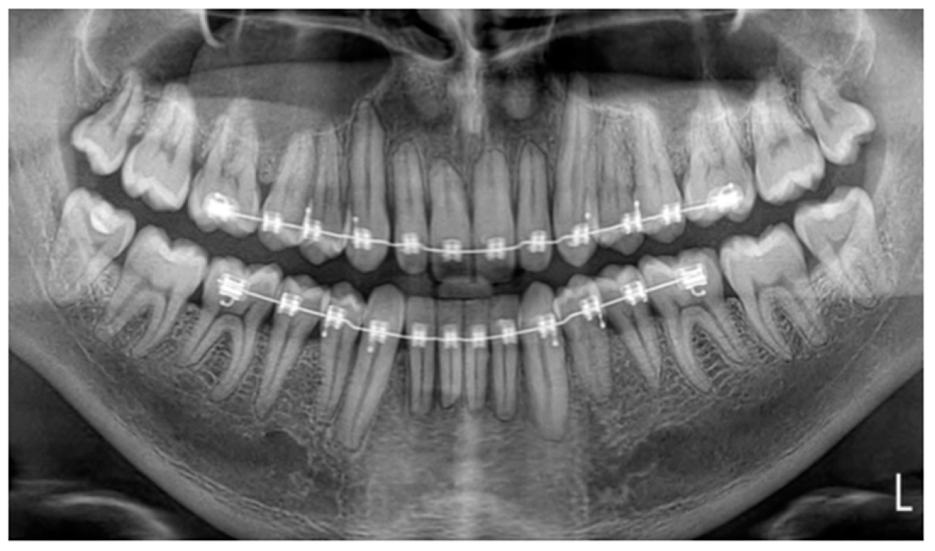 Applsci 13 00922 g004