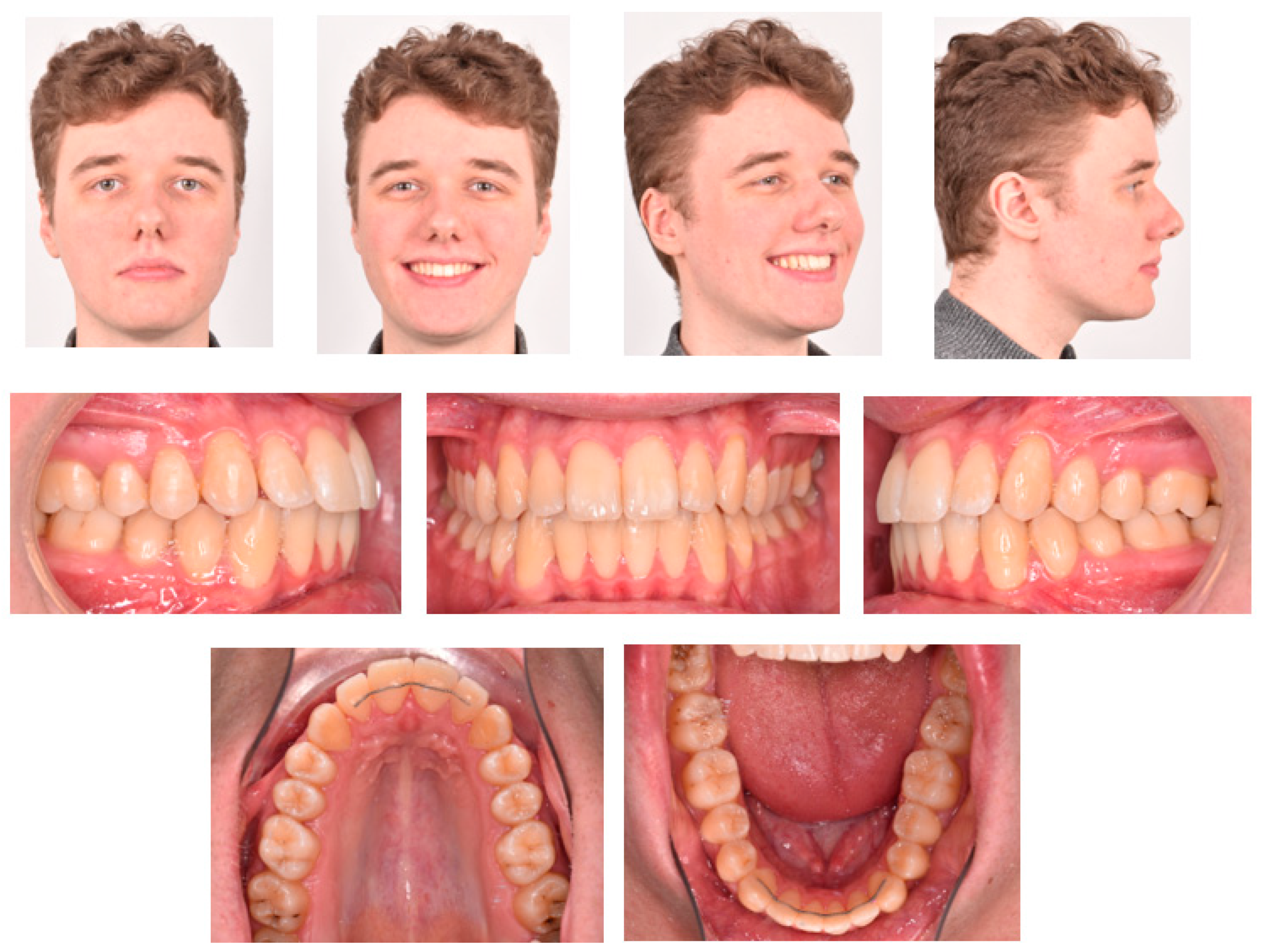 Applsci 13 00922 g005