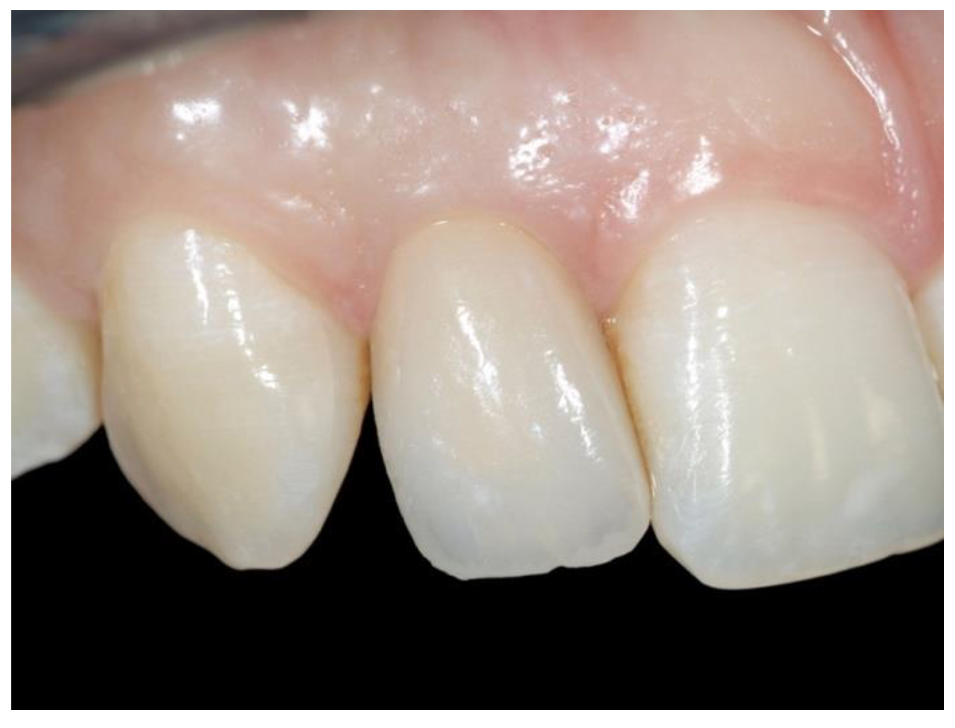 Applsci 13 00964 g004