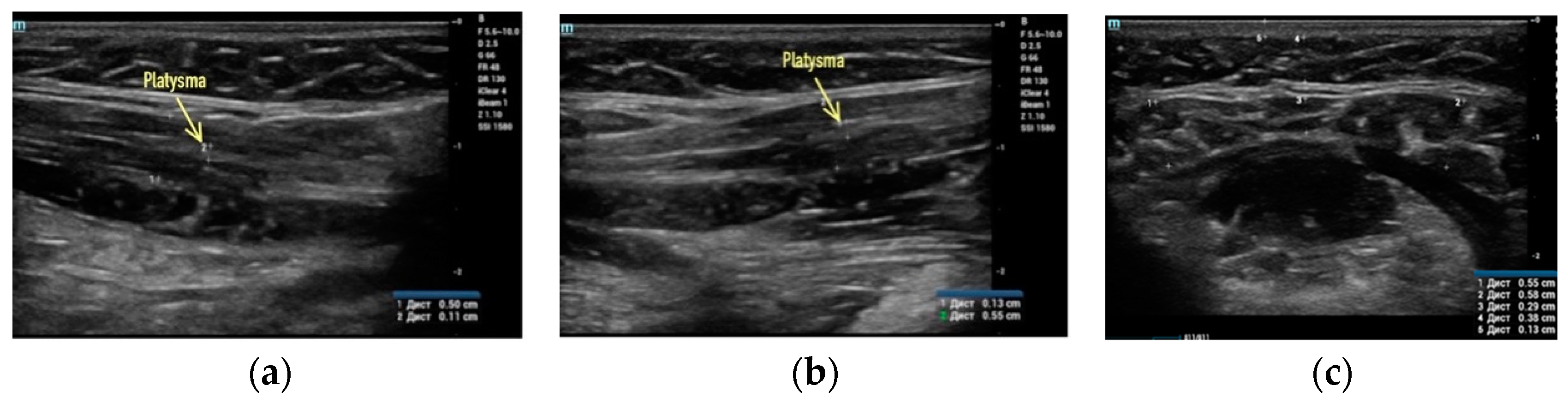 Applsci 13 01128 g002
