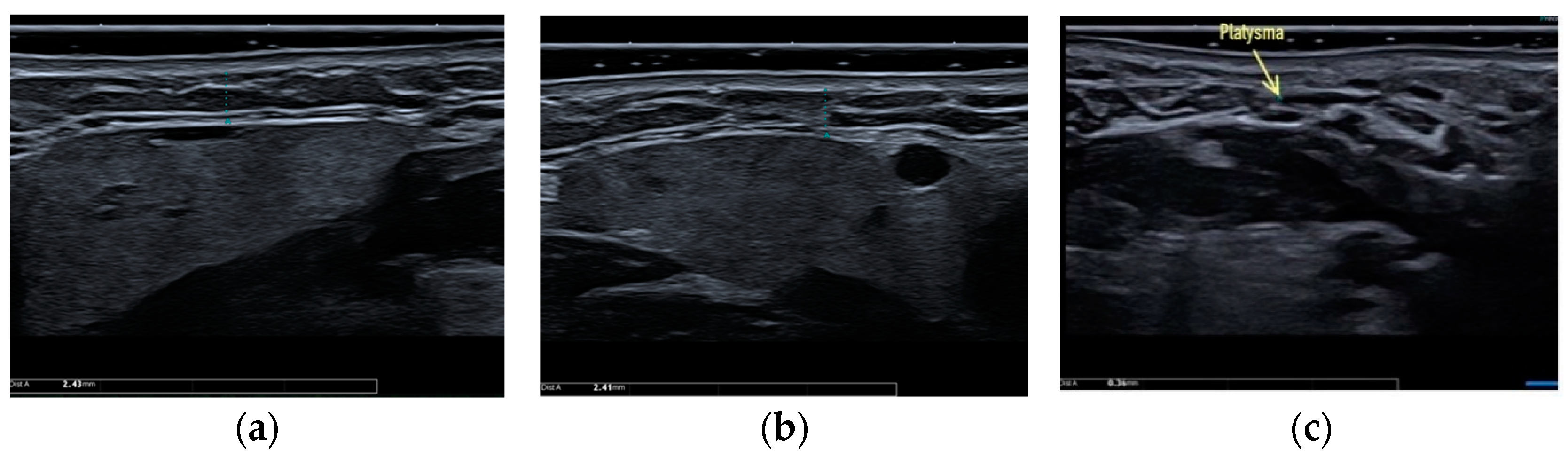 Applsci 13 01128 g003