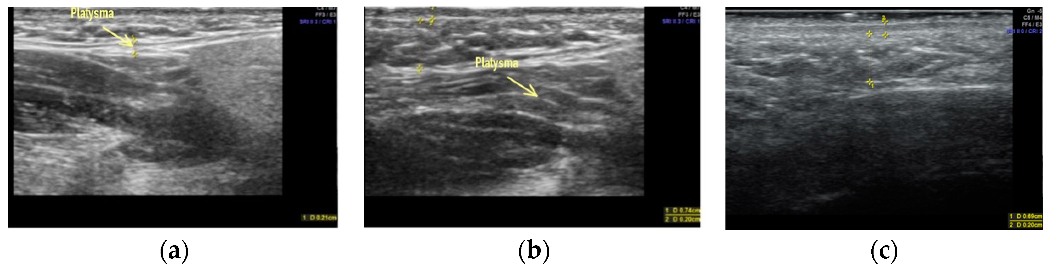 Applsci 13 01128 g005