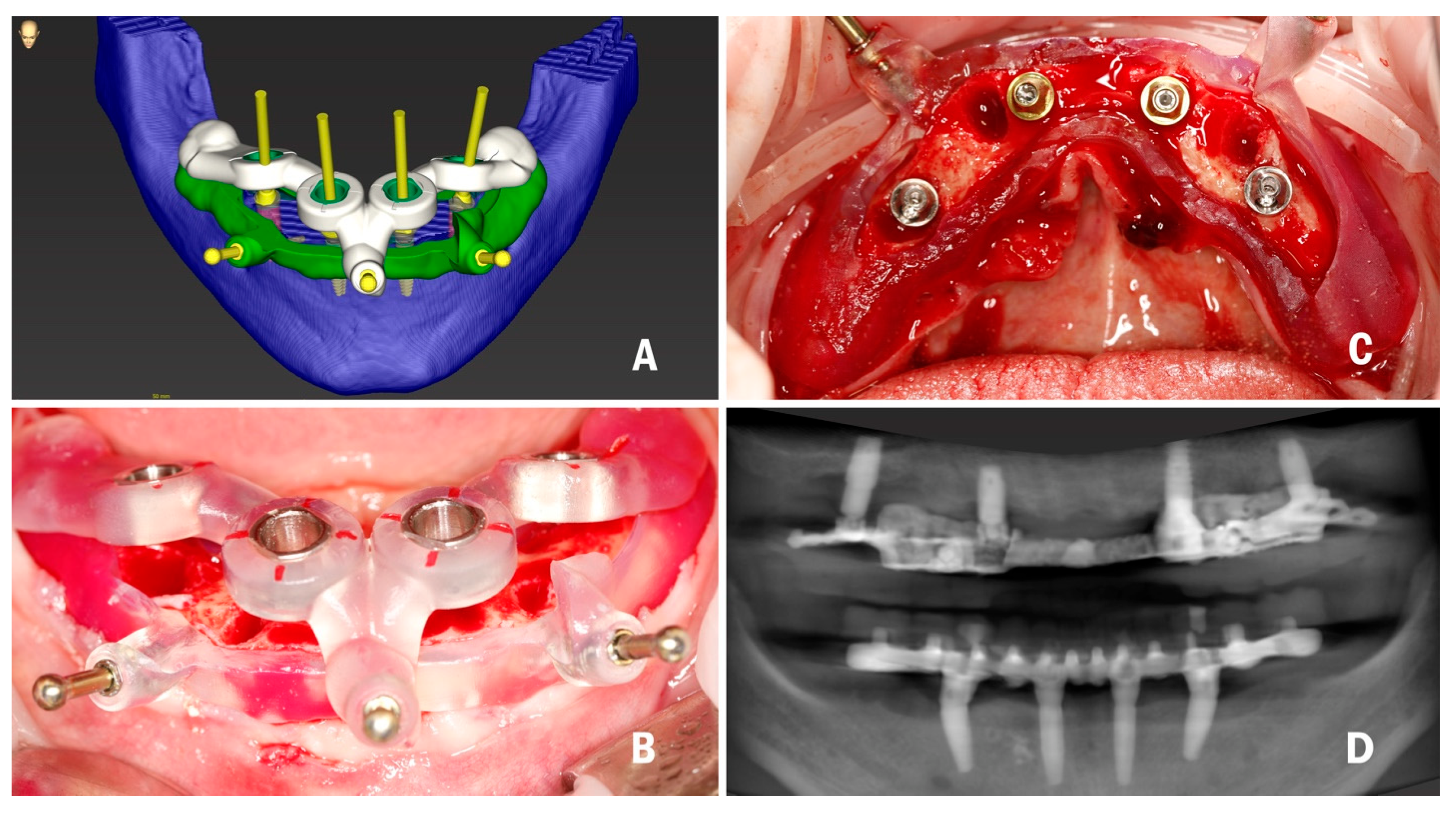Applsci 13 01185 g001