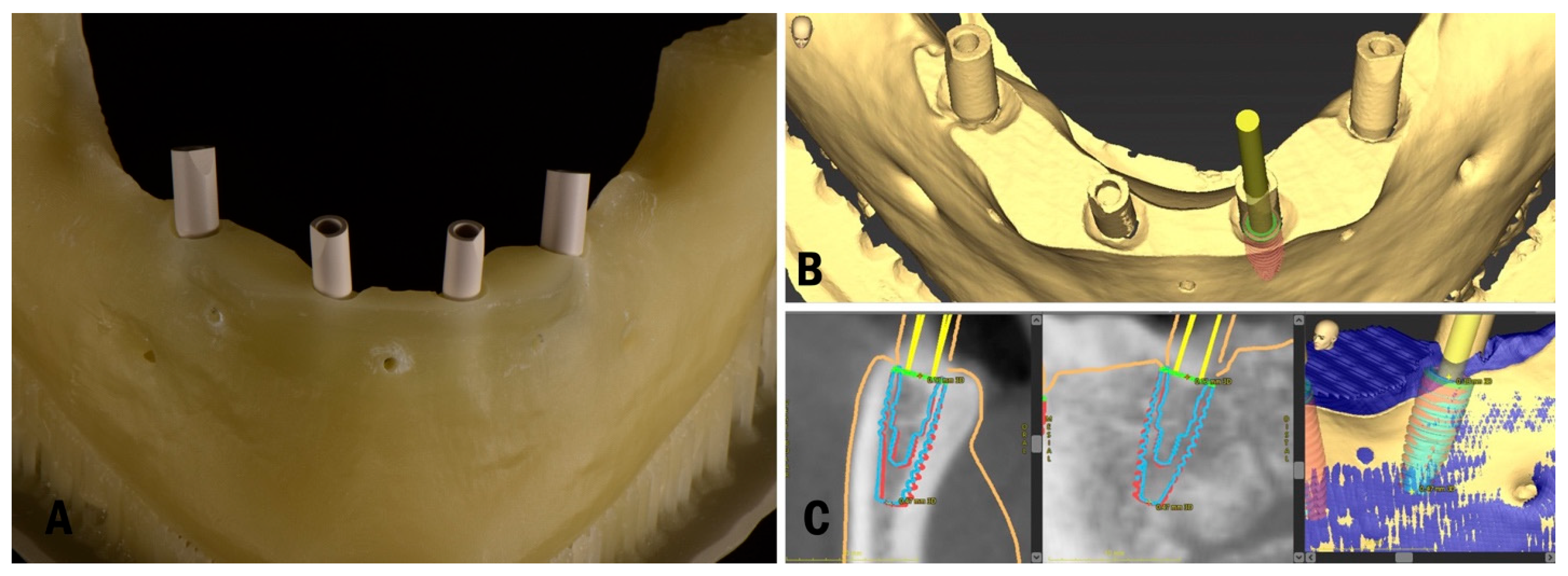 Applsci 13 01185 g004