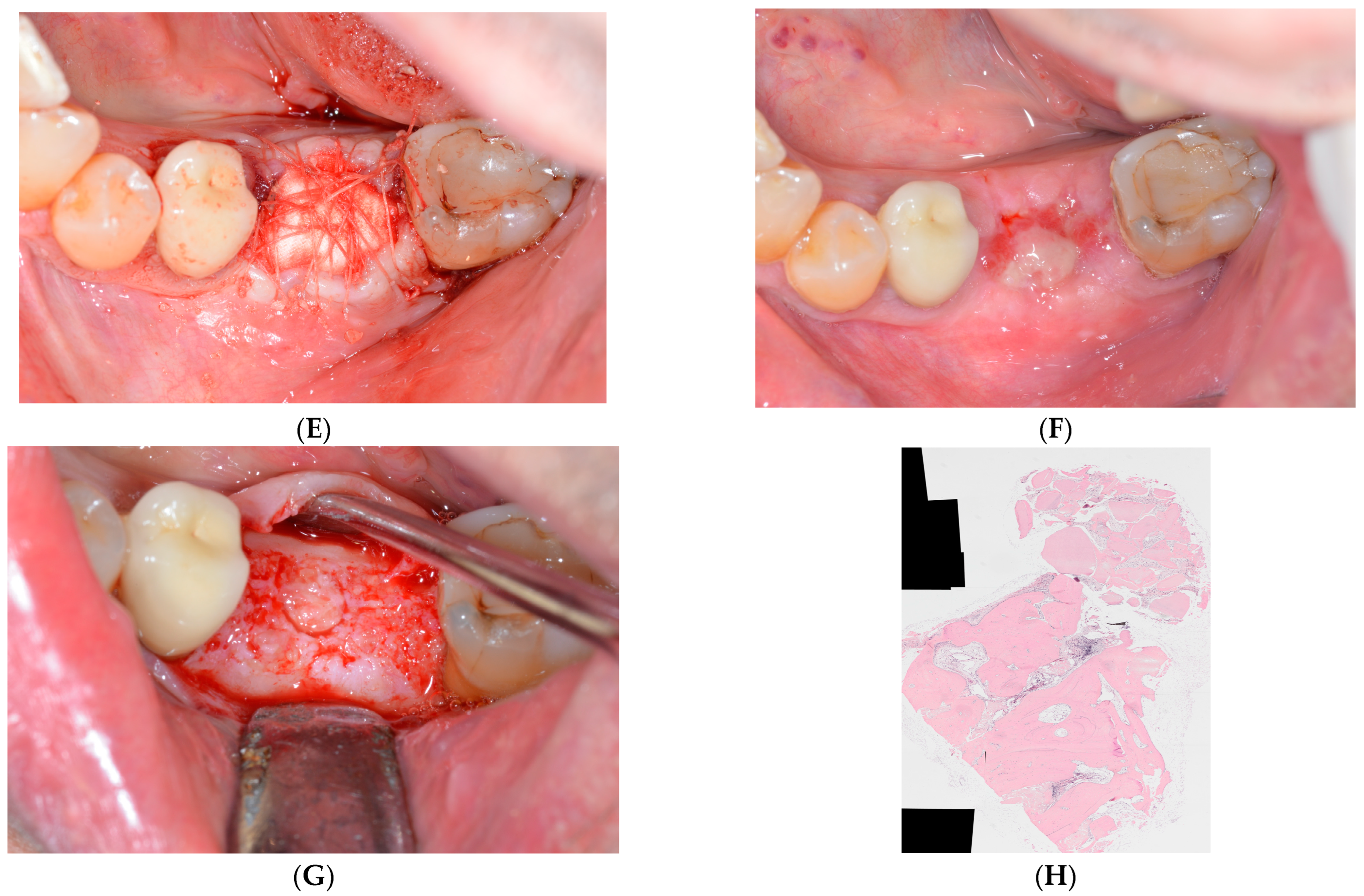 Applsci 13 01411 g001b