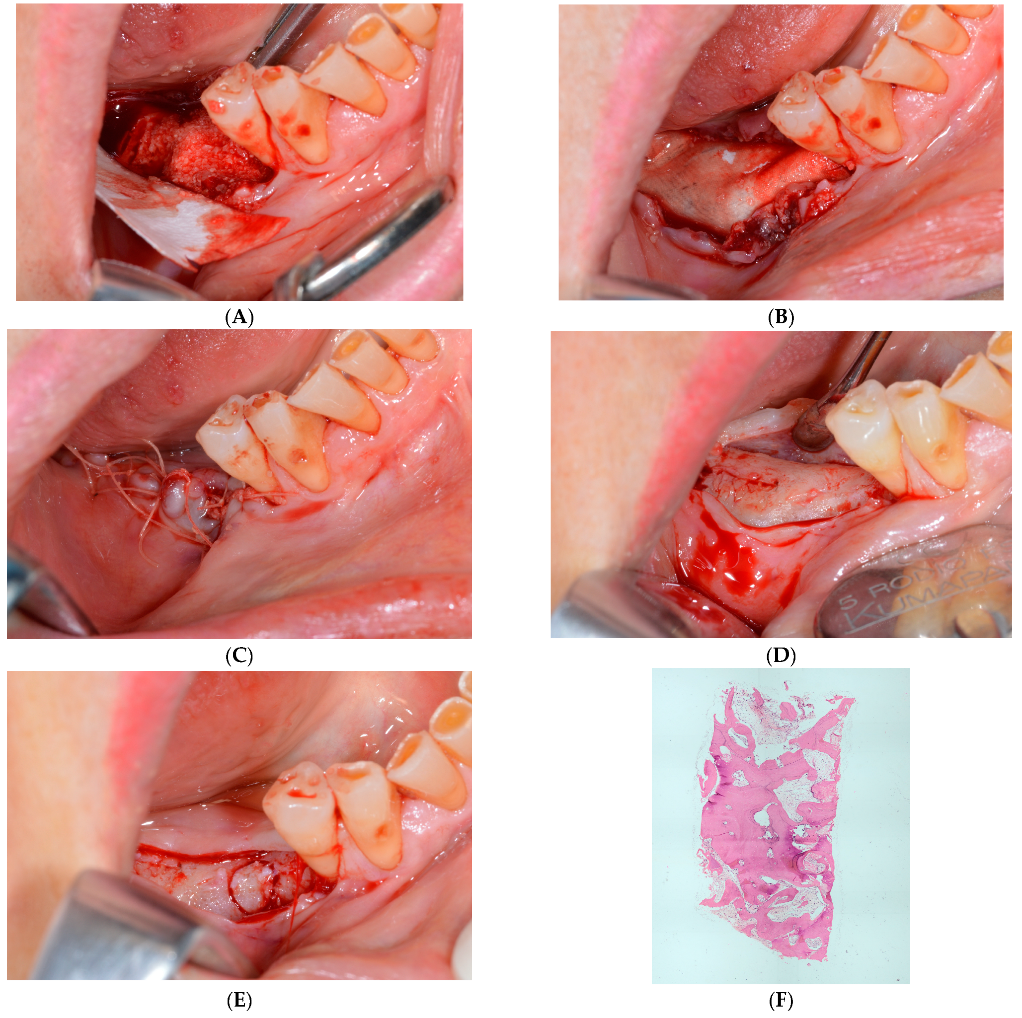 Applsci 13 01411 g002