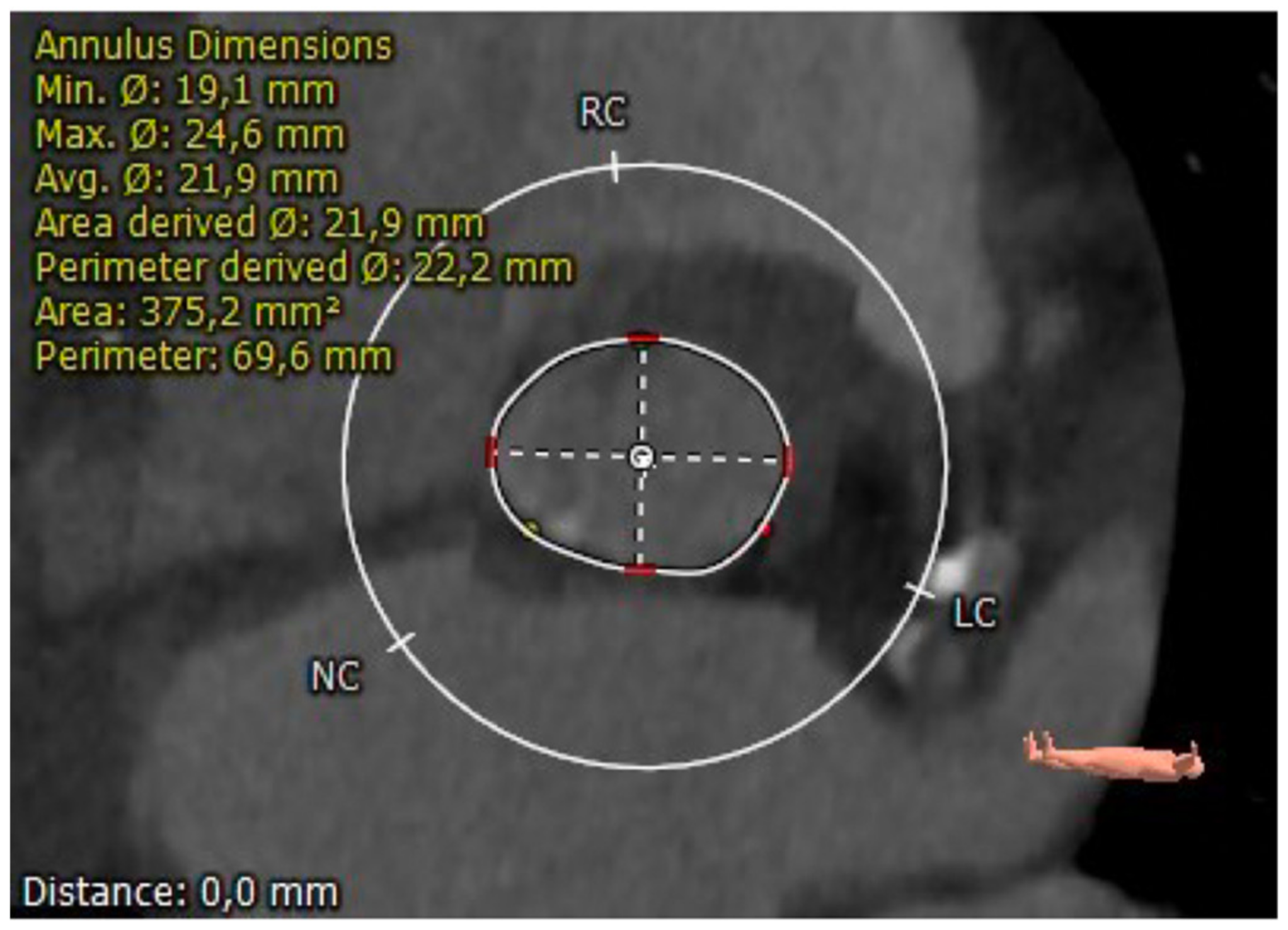 Applsci 13 01589 g003