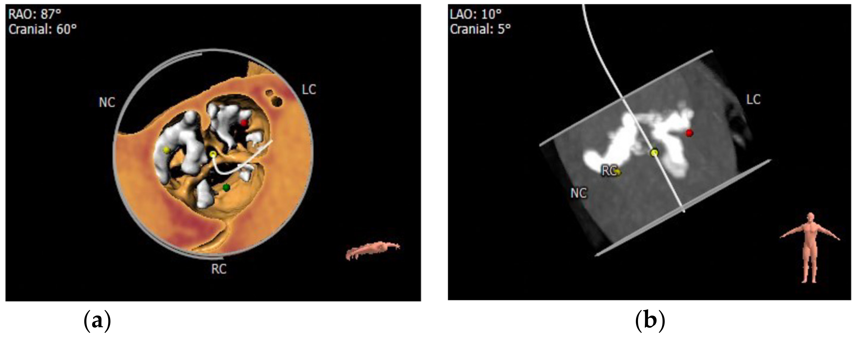 Applsci 13 01589 g004