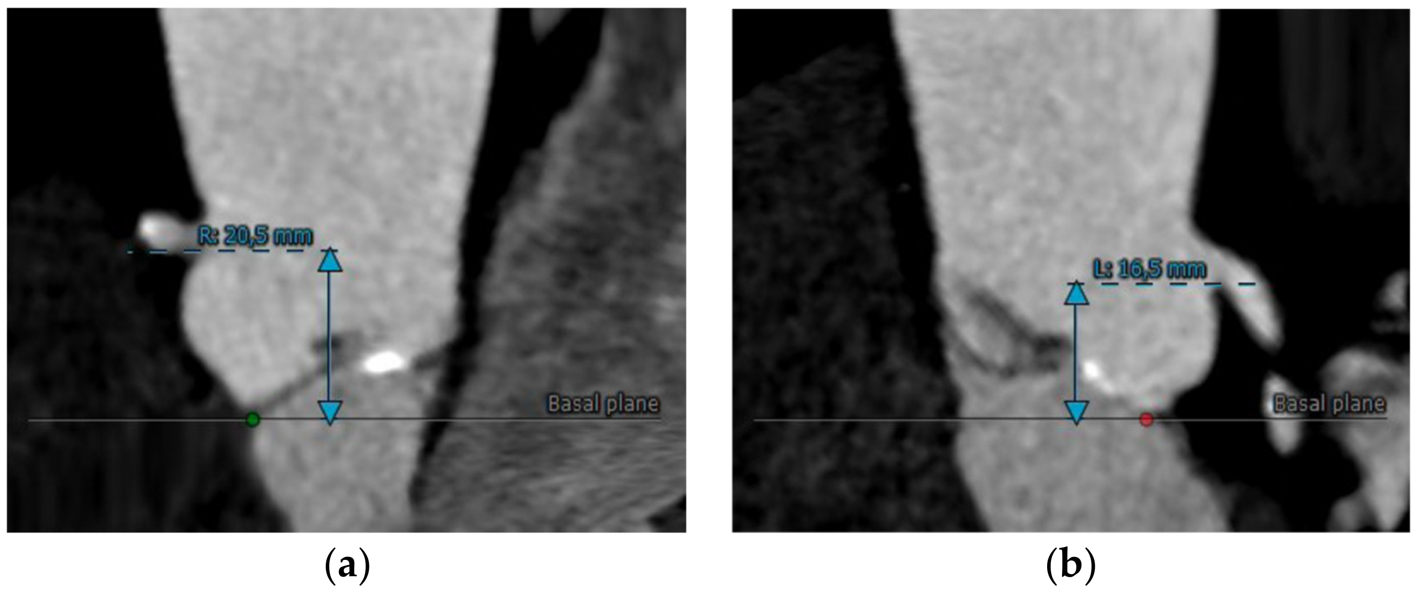 Applsci 13 01589 g006