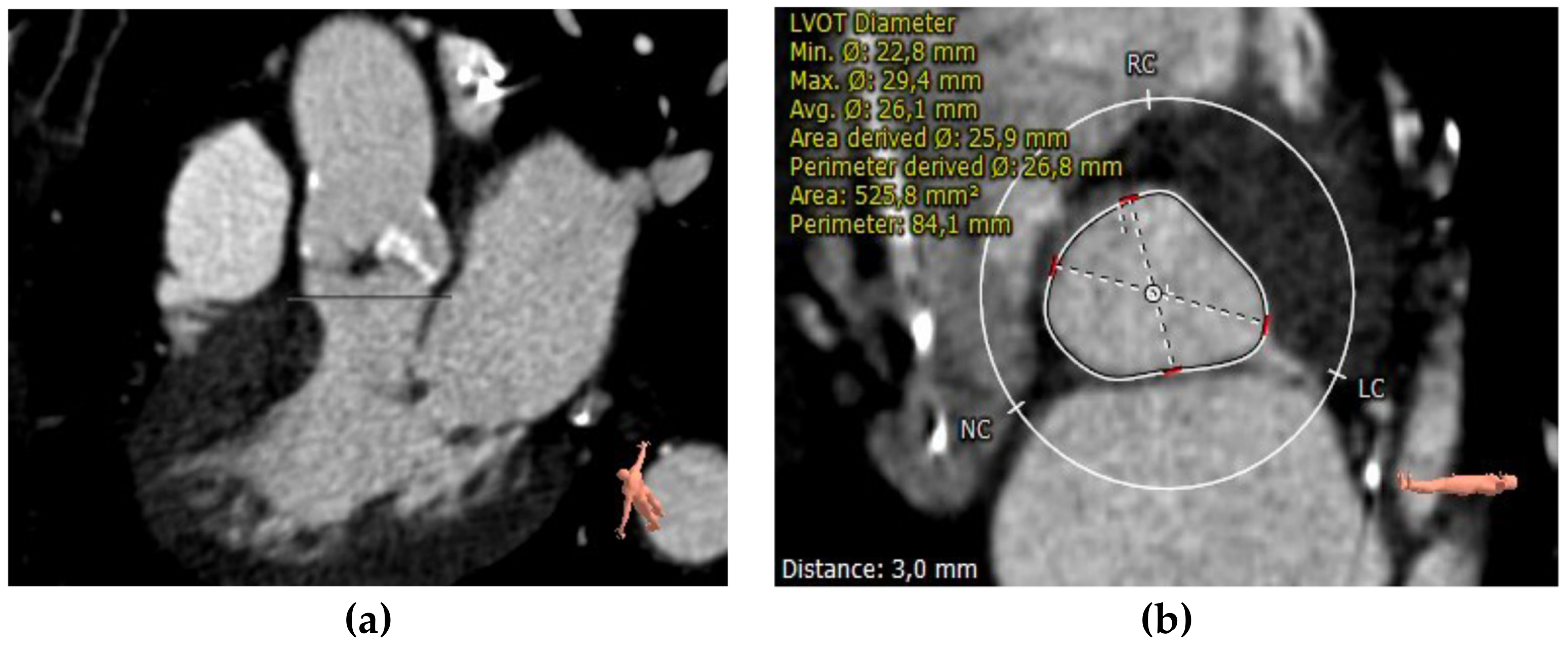 Applsci 13 01589 g008