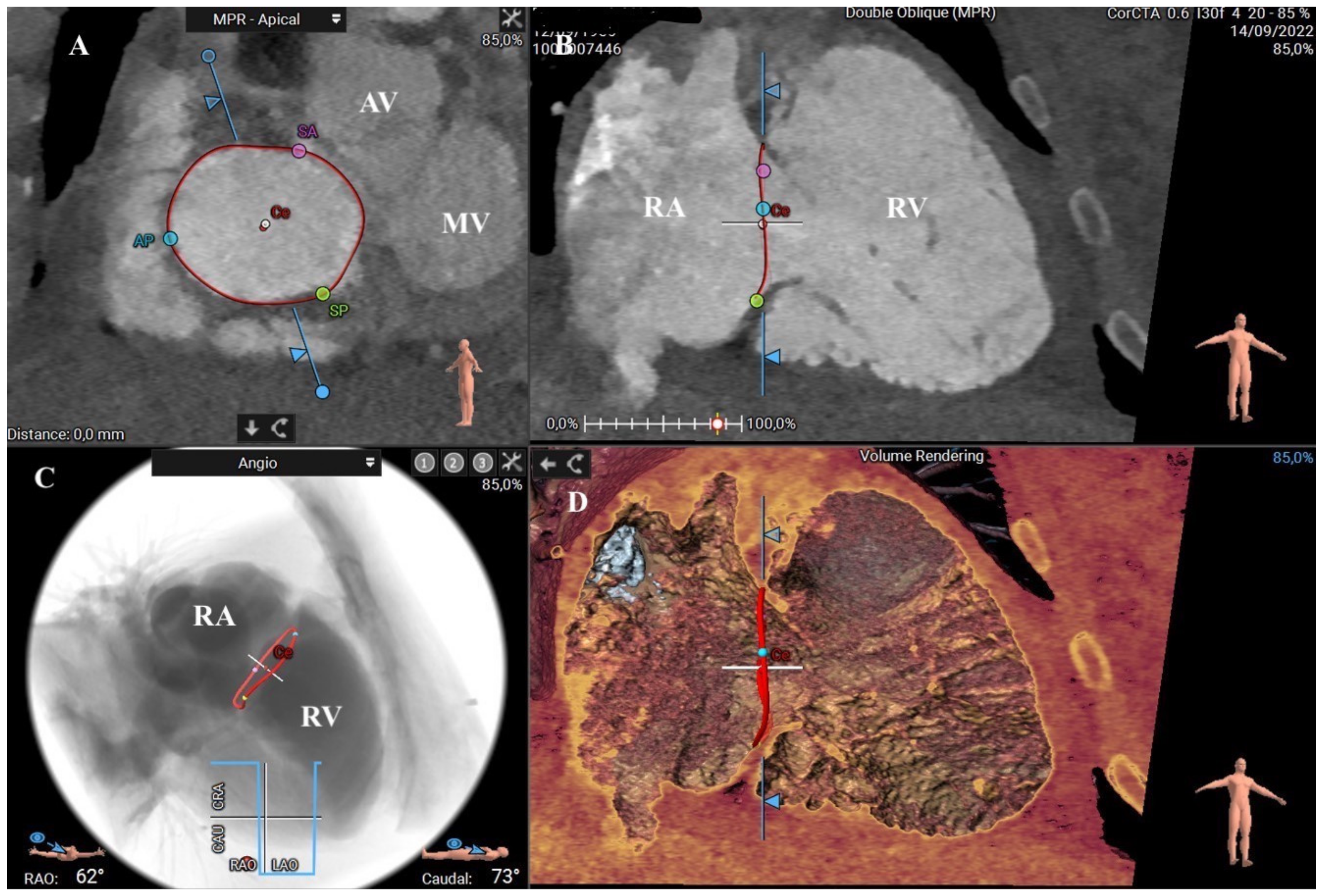 Applsci 13 01589 g011