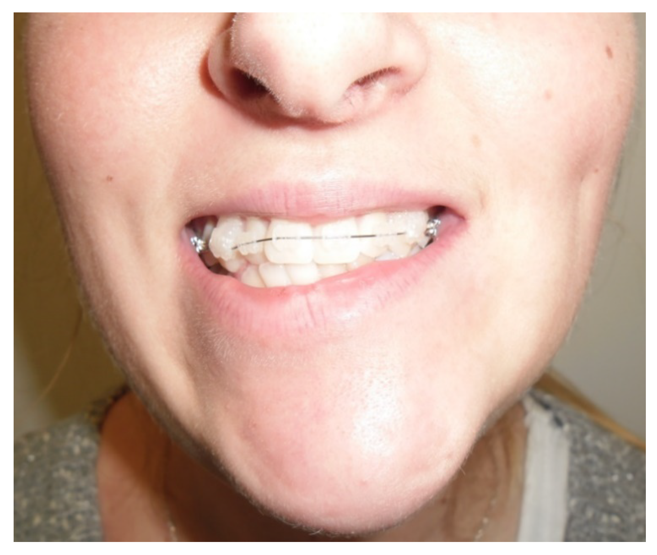 Applsci 13 01839 g002