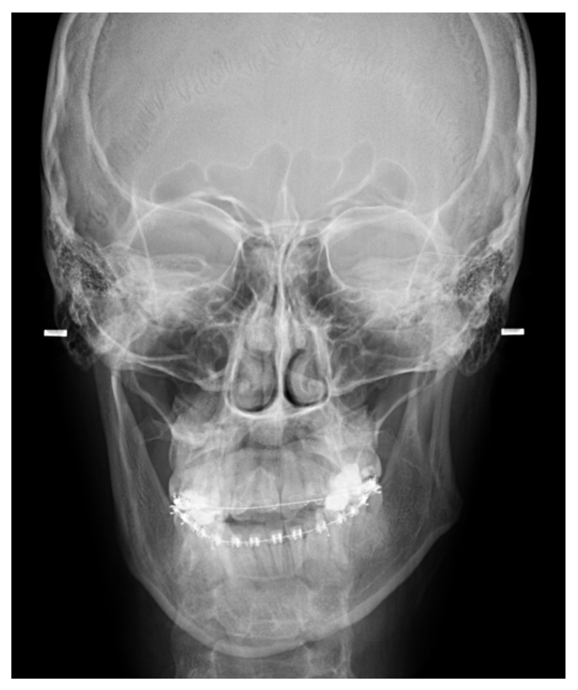 Applsci 13 01839 g003