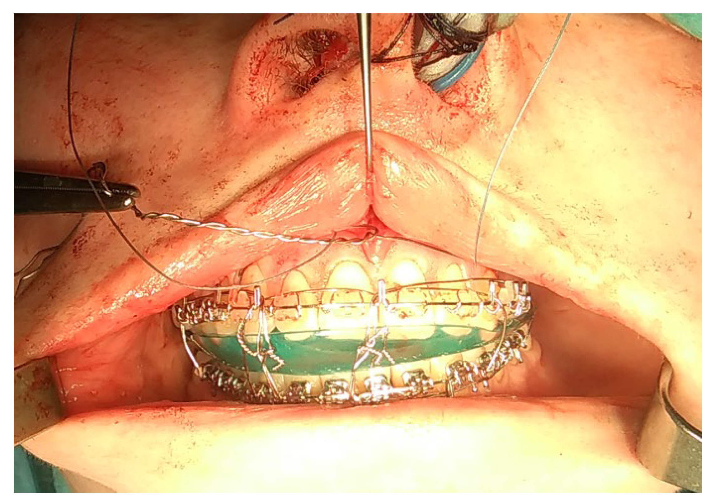 Applsci 13 01839 g007