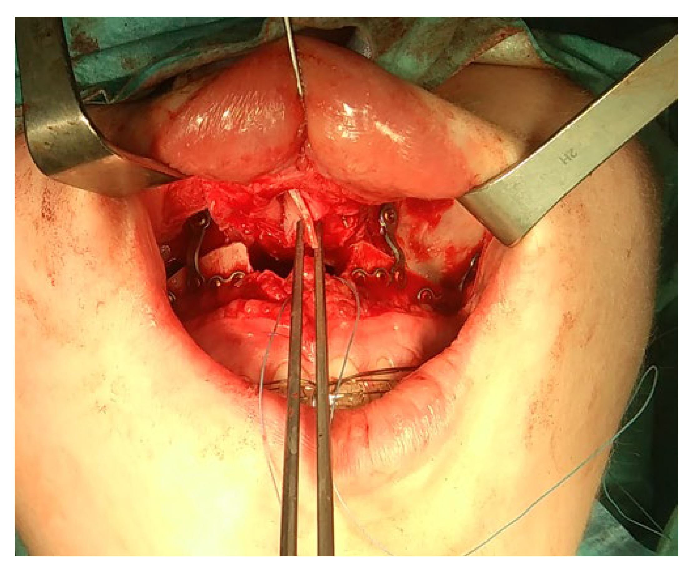 Applsci 13 01839 g009