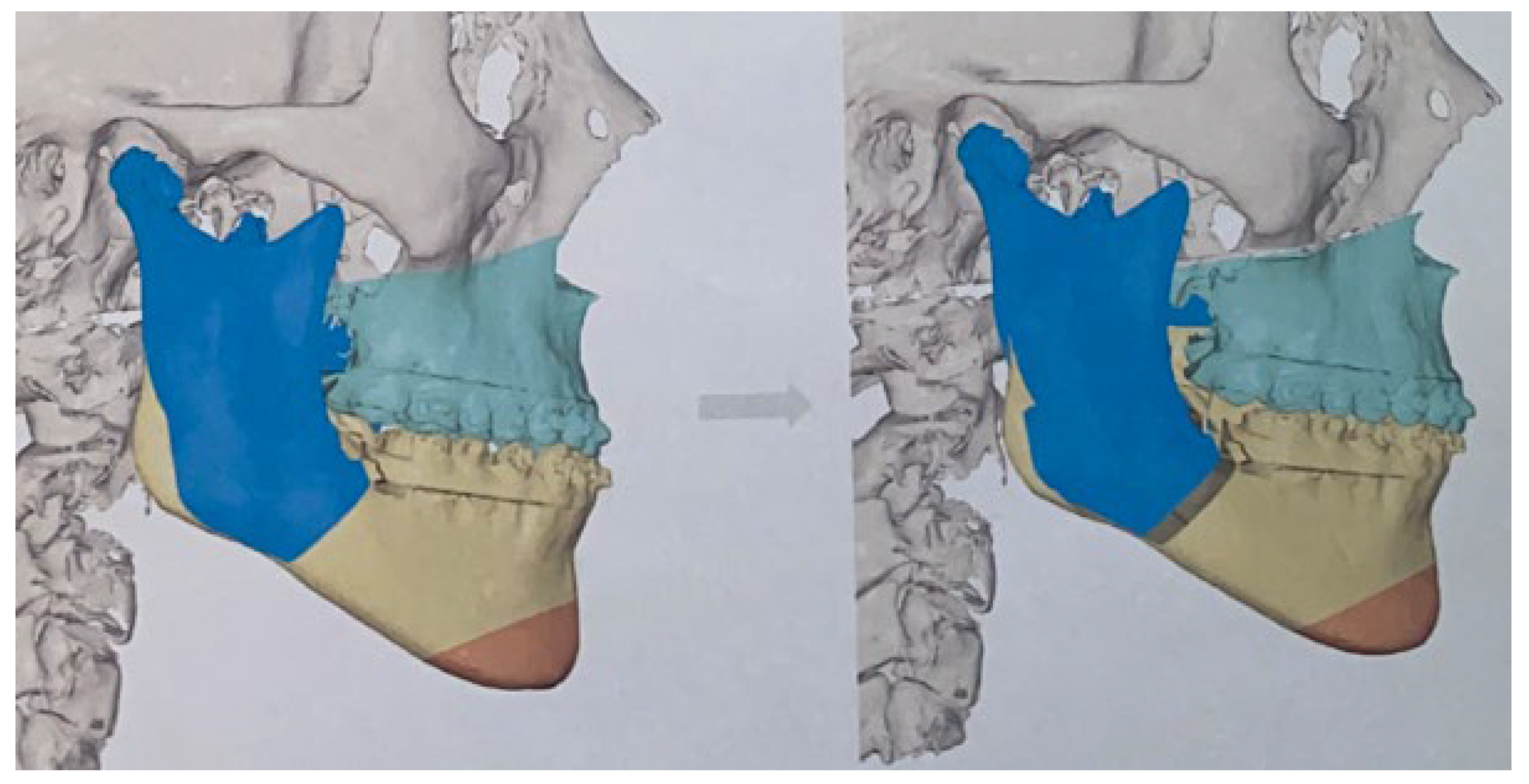 Applsci 13 01839 g010