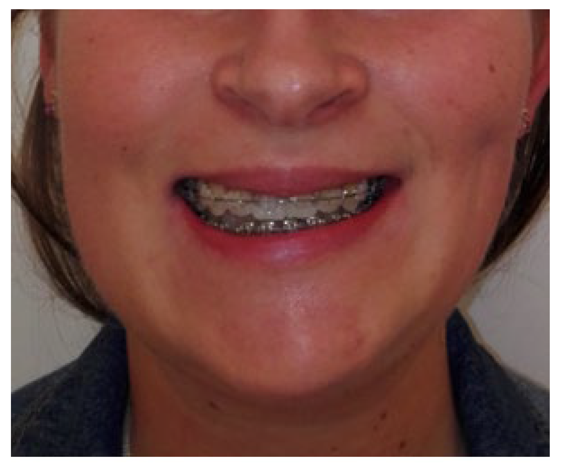 Applsci 13 01839 g013