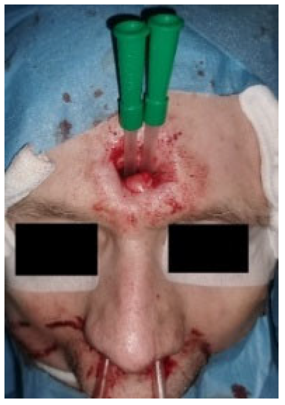 Applsci 13 02107 g006