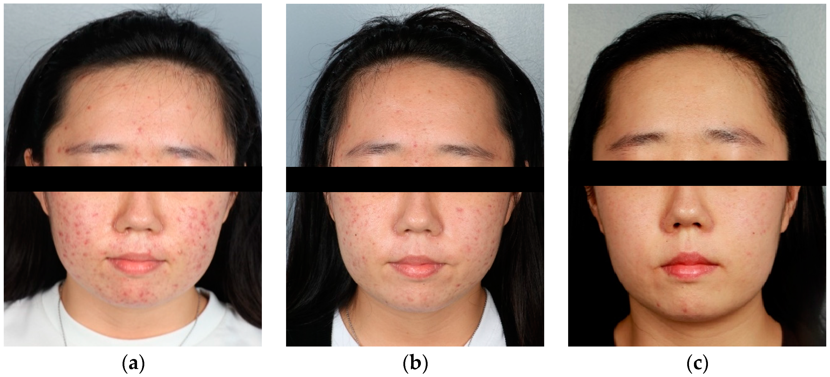 Applsci 13 02114 g004a