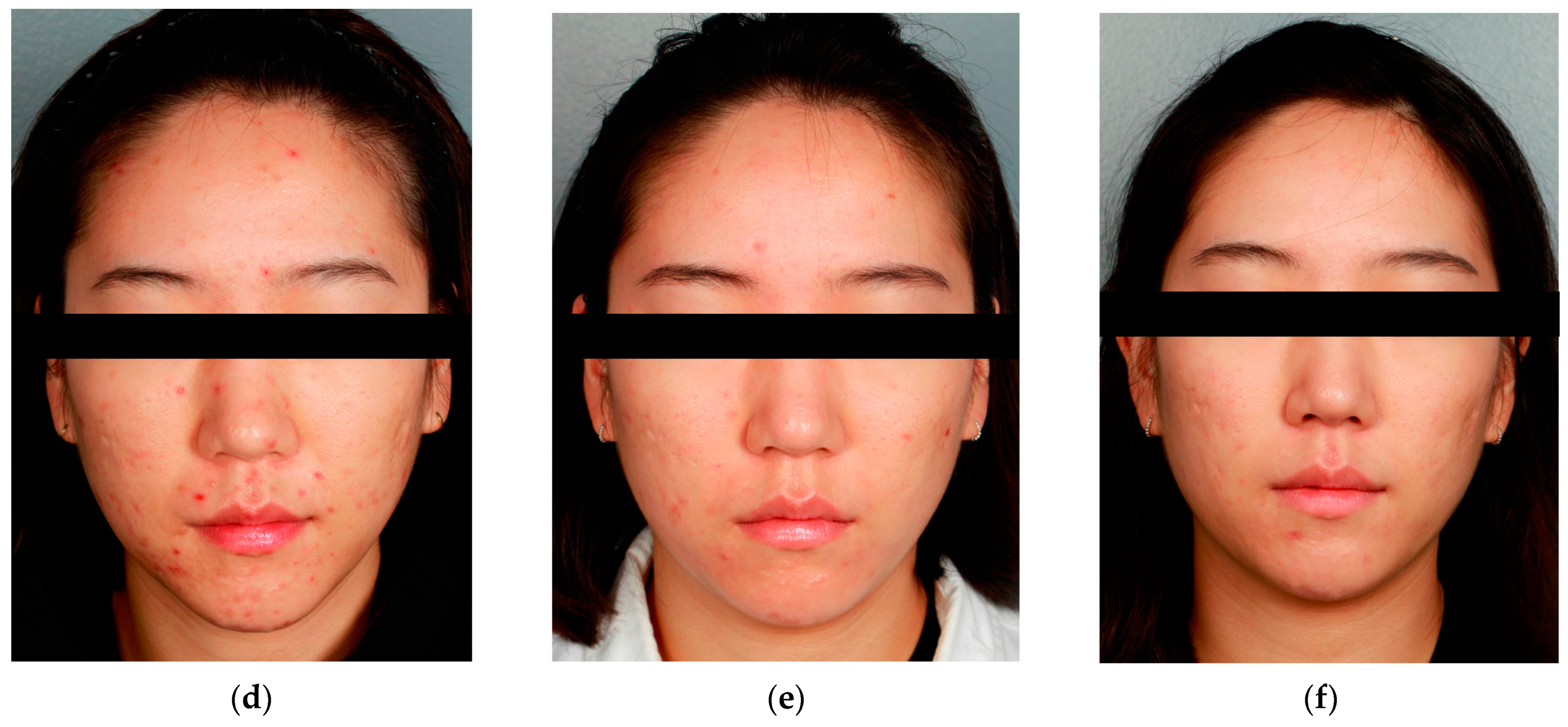 Applsci 13 02114 g004b