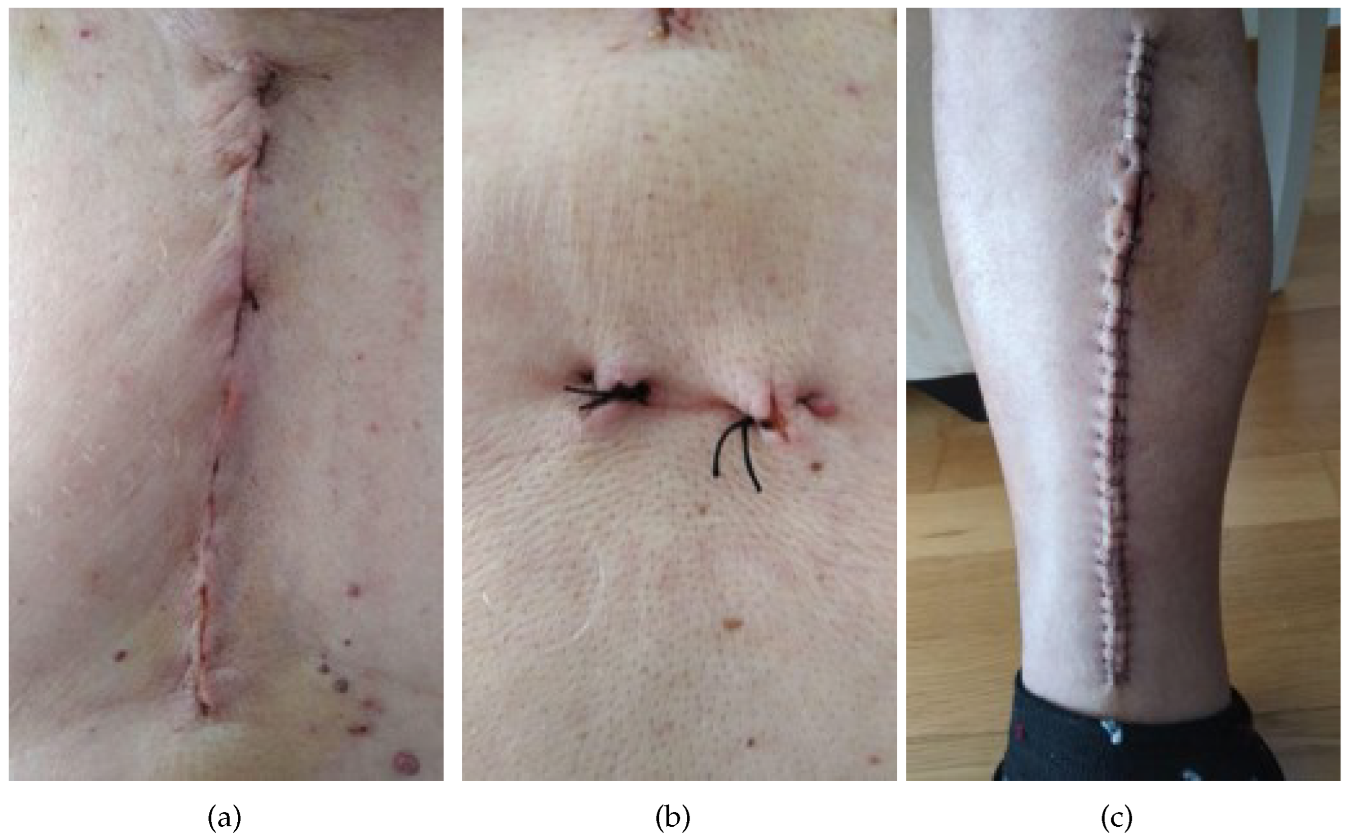 Applsci 13 02120 g001