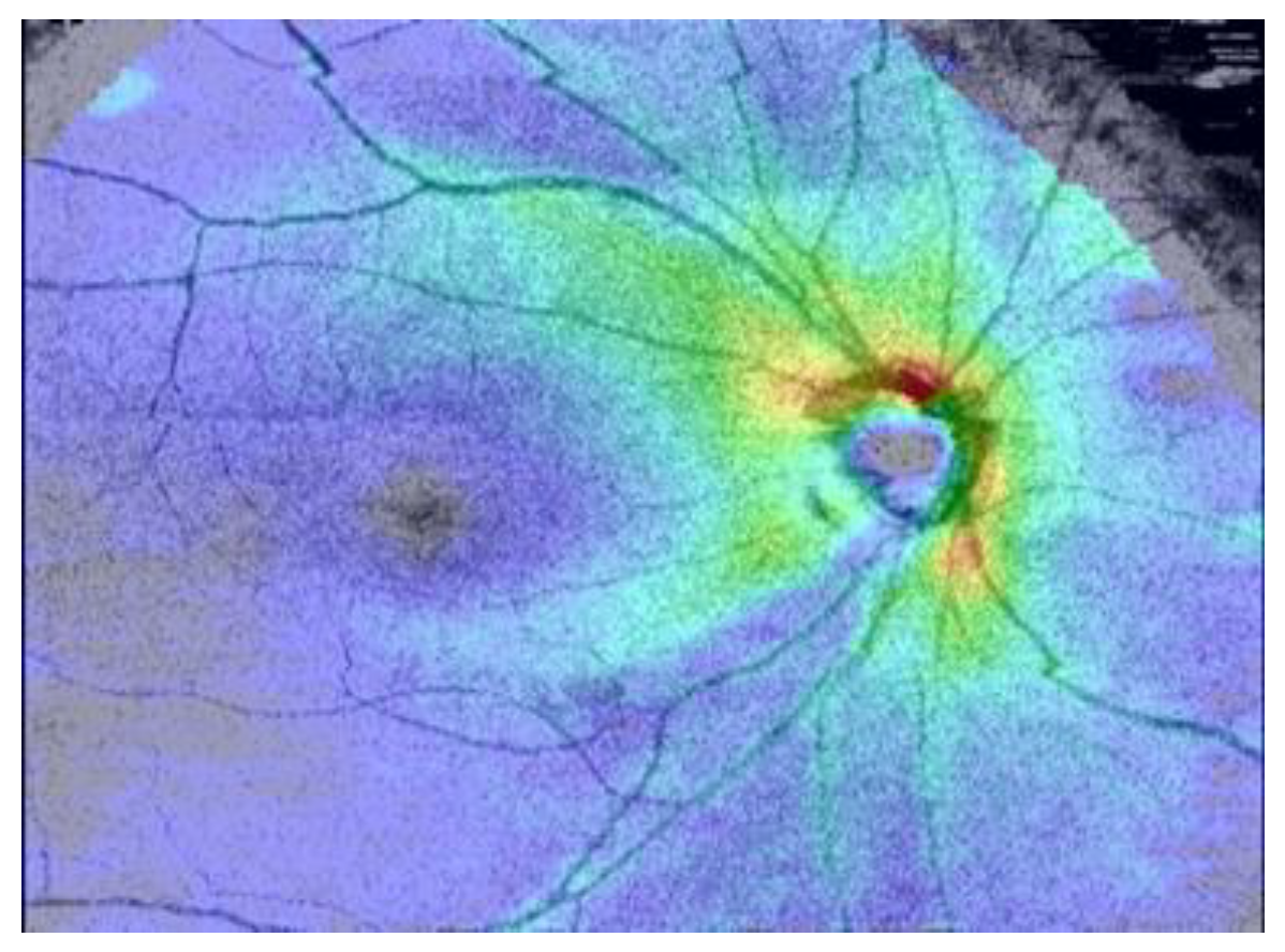 Applsci 13 02195 g003