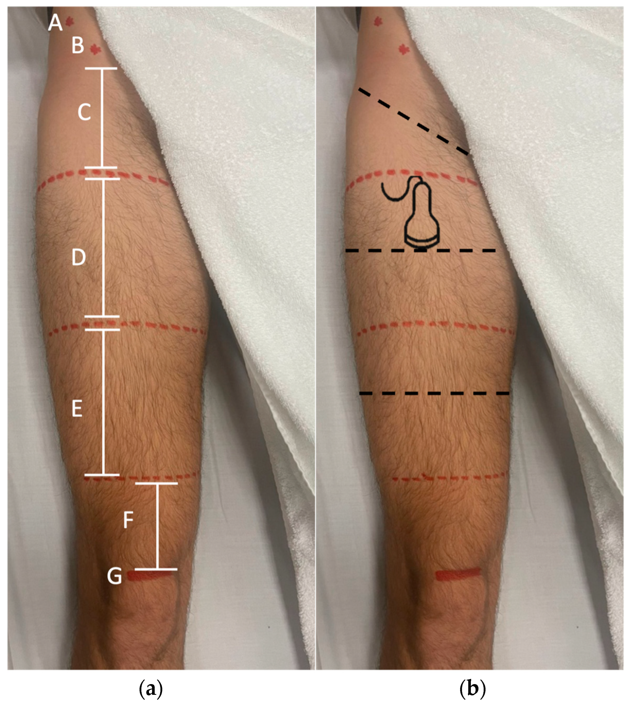 Applsci 13 02589 g001