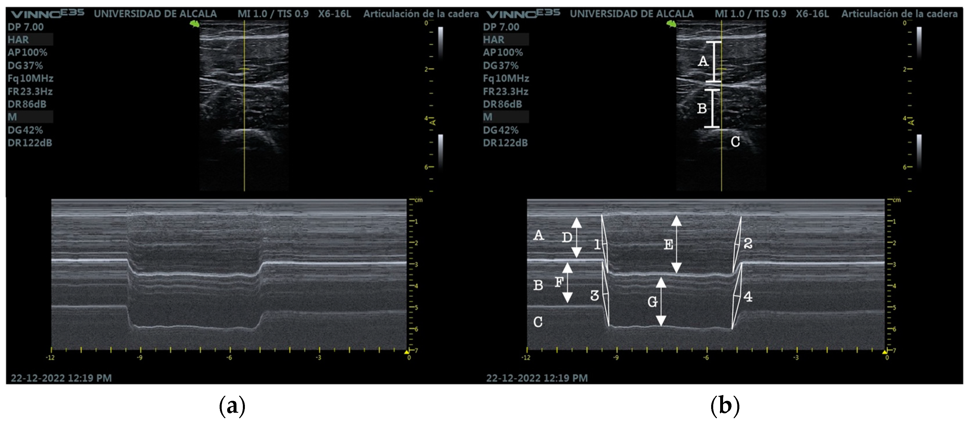 Applsci 13 02589 g002