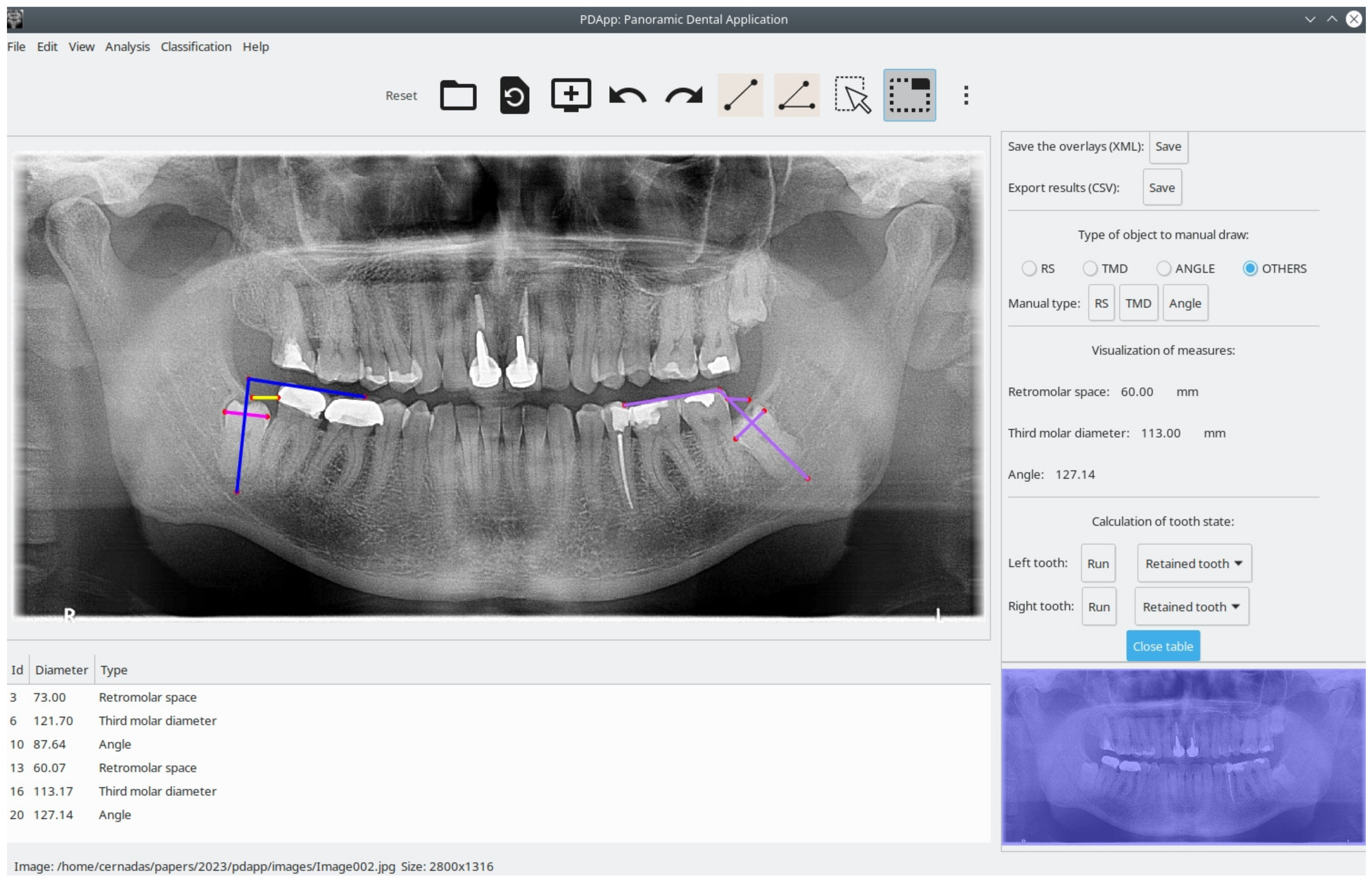 Applsci 13 02848 g003