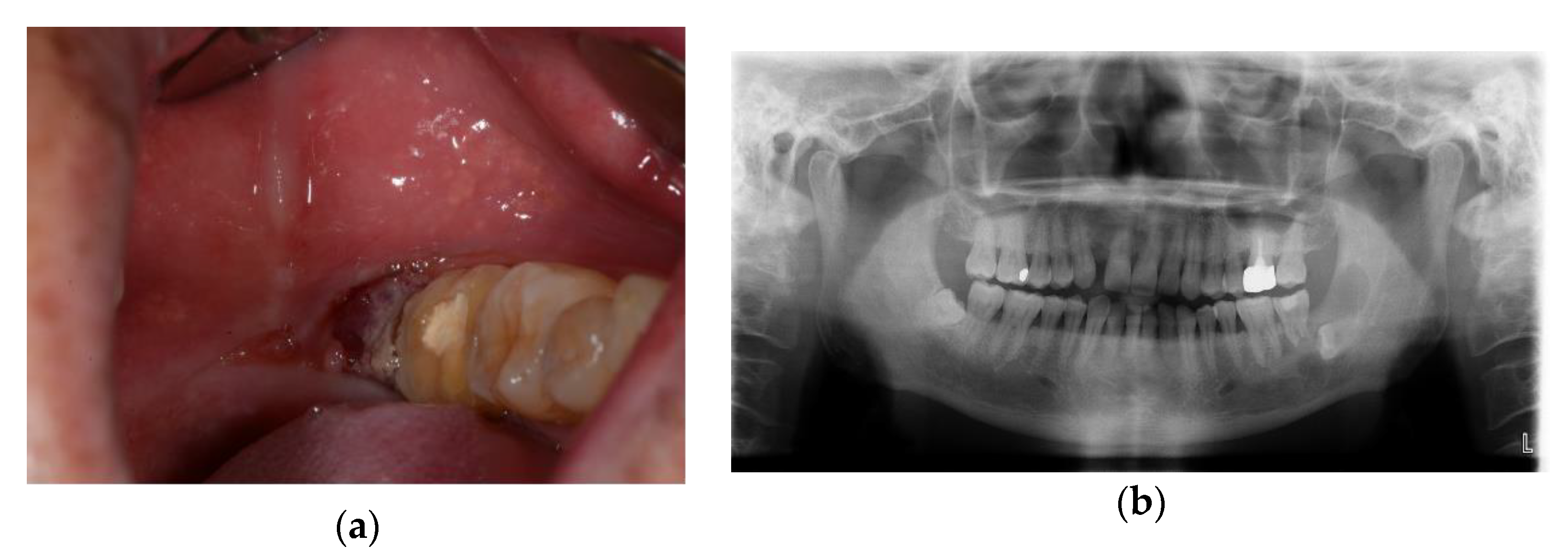 Applsci 13 02855 g005 Applsci 13 02855 g005